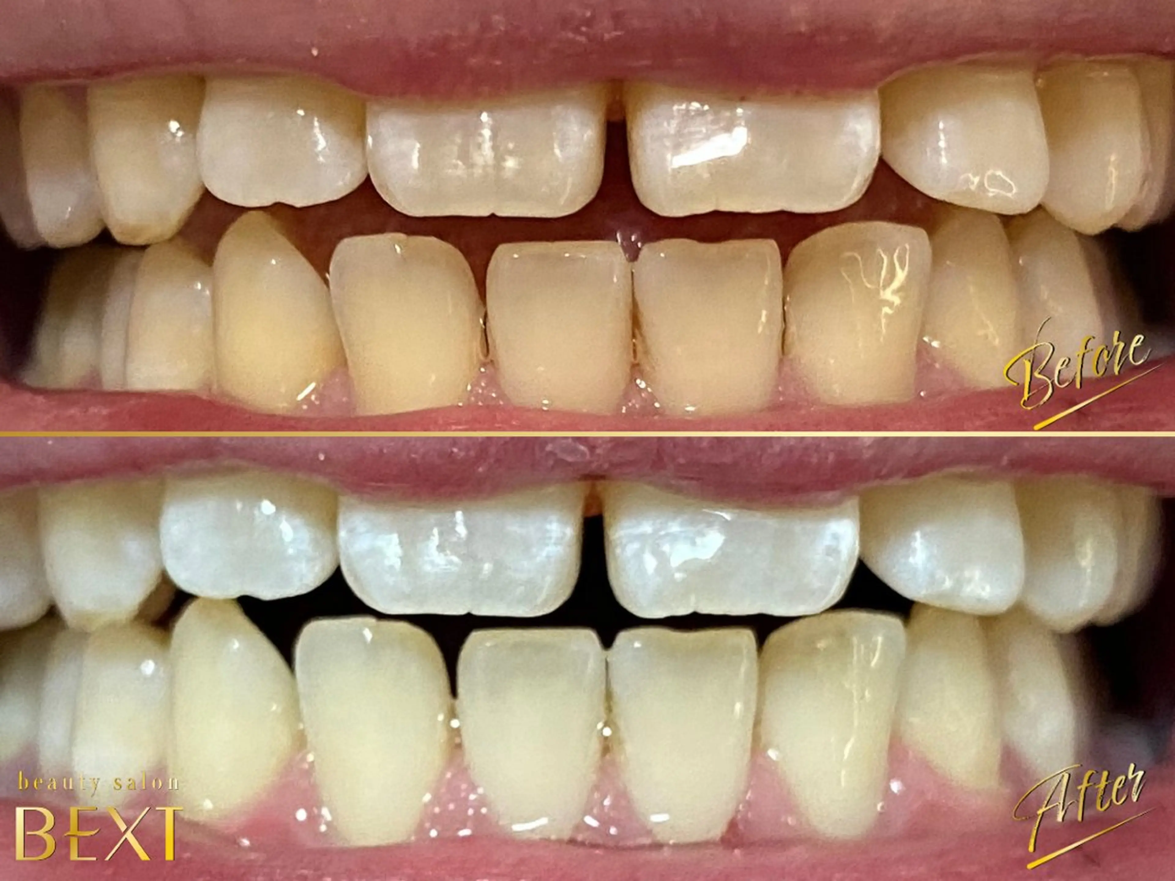 メンズ エステ リラク ビューティーサロンベクスト beautysalonBEXT所属・ビューティーサロン ベクスト名古屋のエステ・リラクイメージ