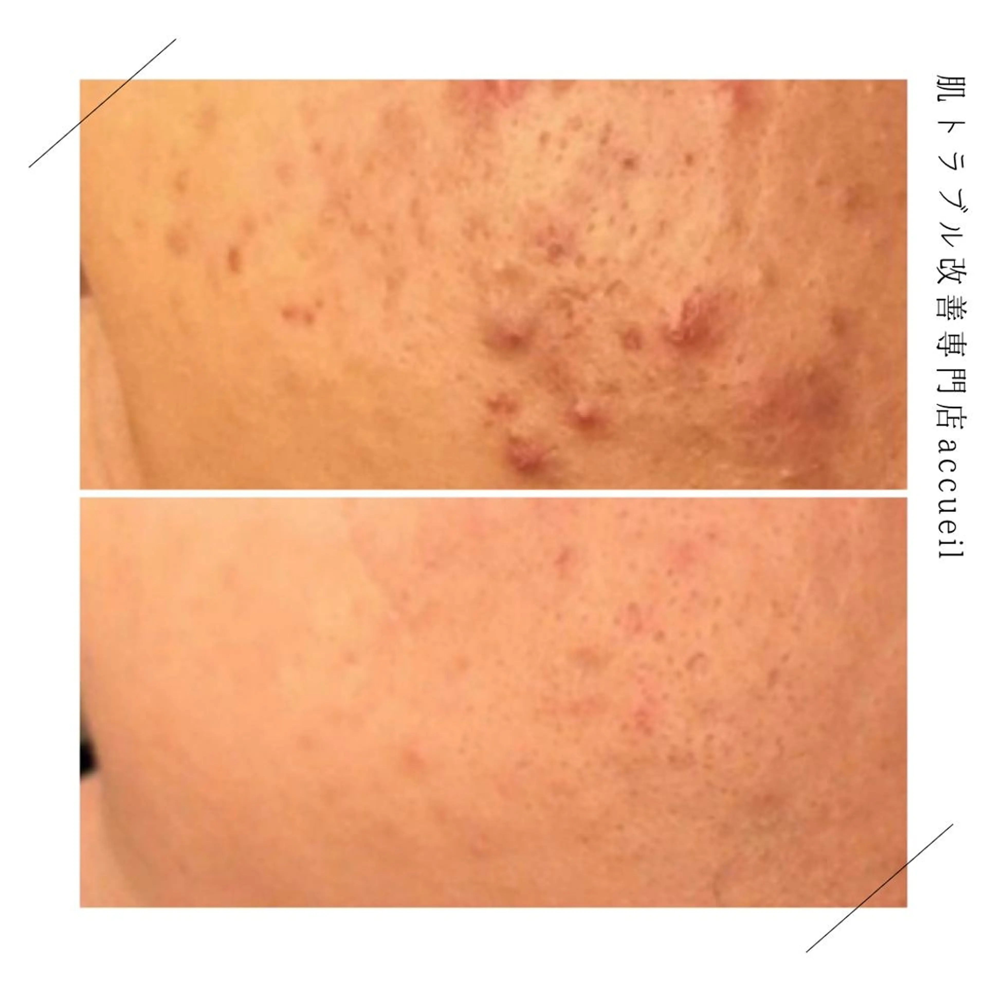 セミロング カラー パーマ ヘアアレンジ メンズ キッズ ネイル マツエク・マツパ アイブロウ 触れたくなる モテ肌へ...❤︎のエステ・リラクイメージ