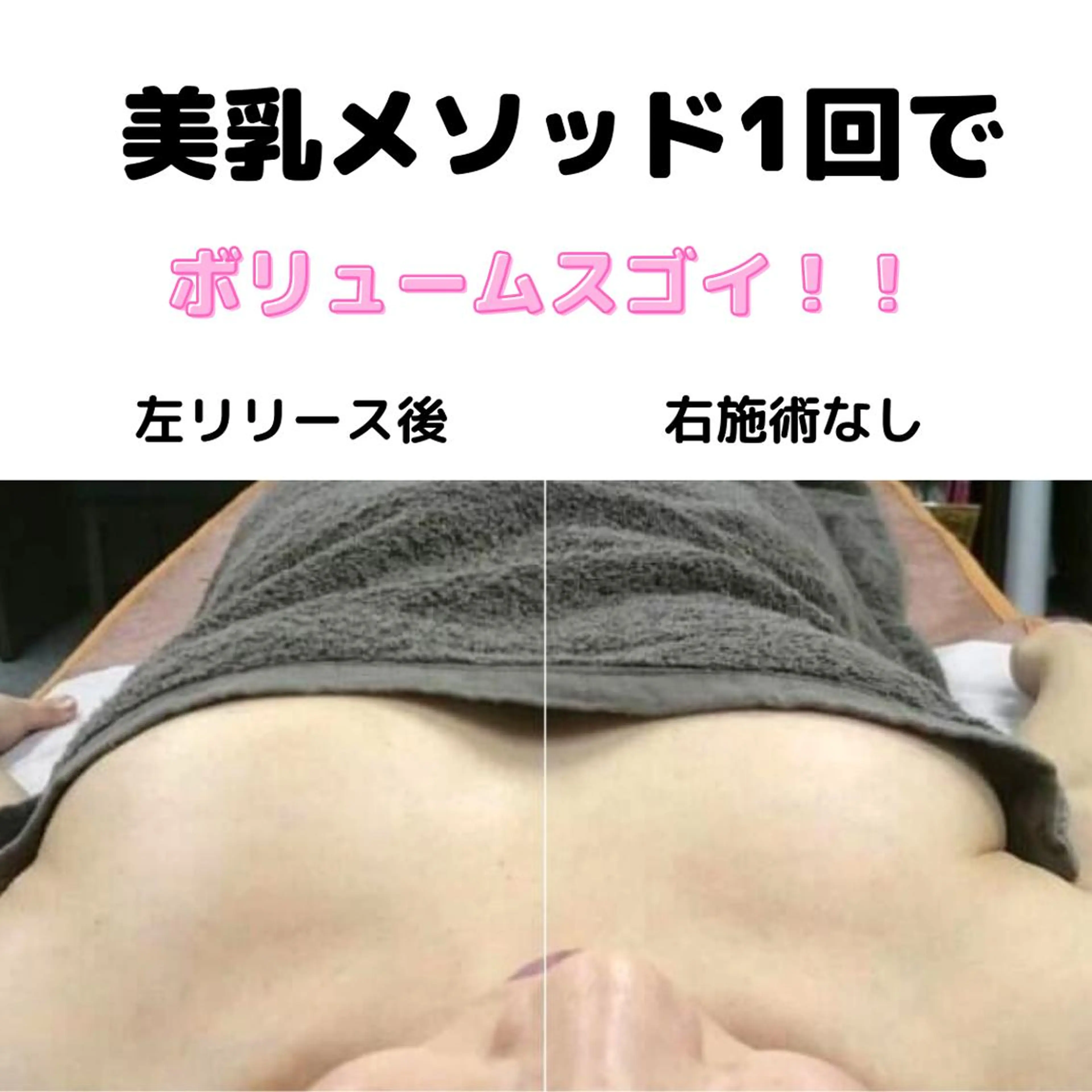 ボリュームバスト&背中美人WでGET❤美乳メソッドの写真