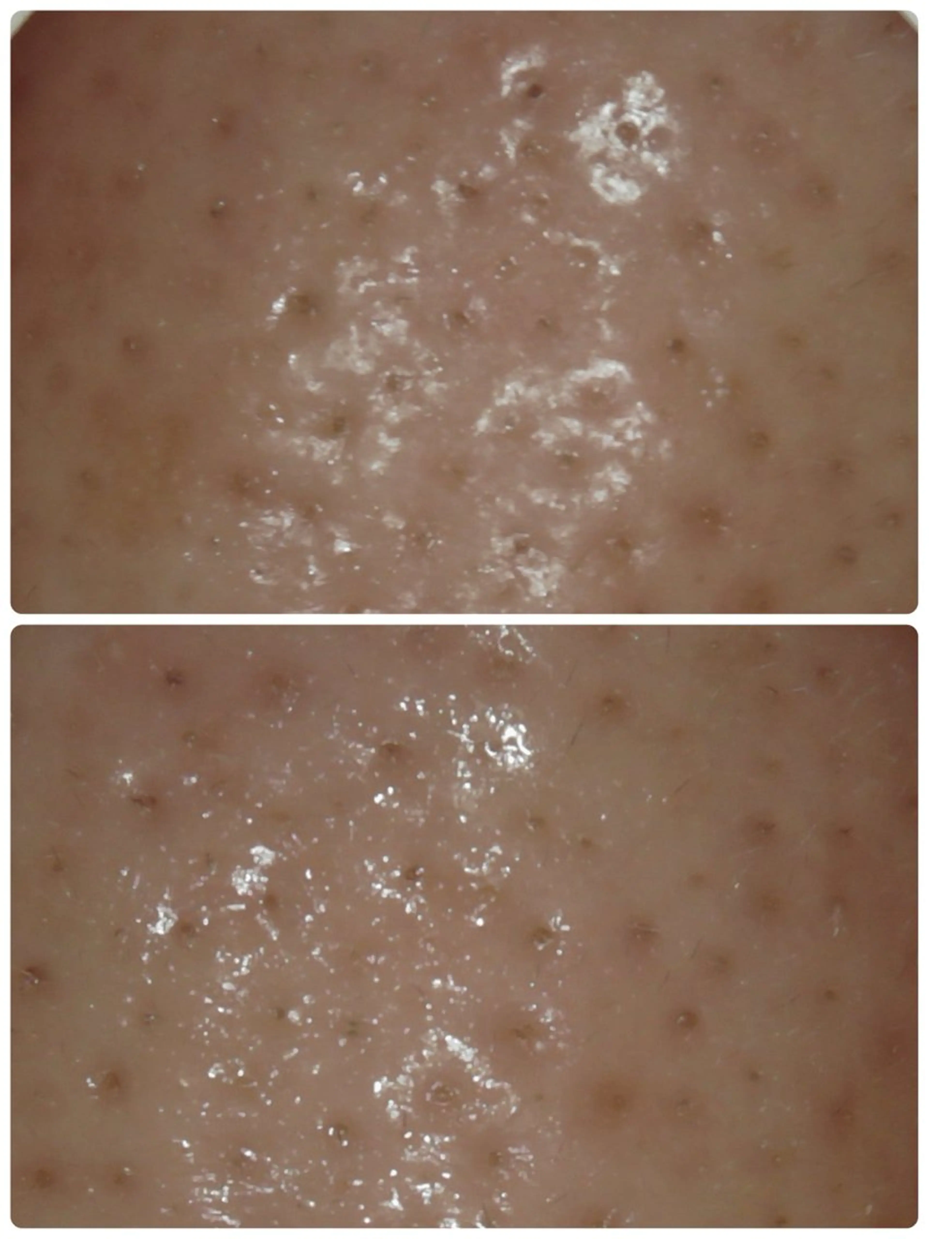 エステ リラク メナード片町 やまもと みくのエステ・リラクイメージ