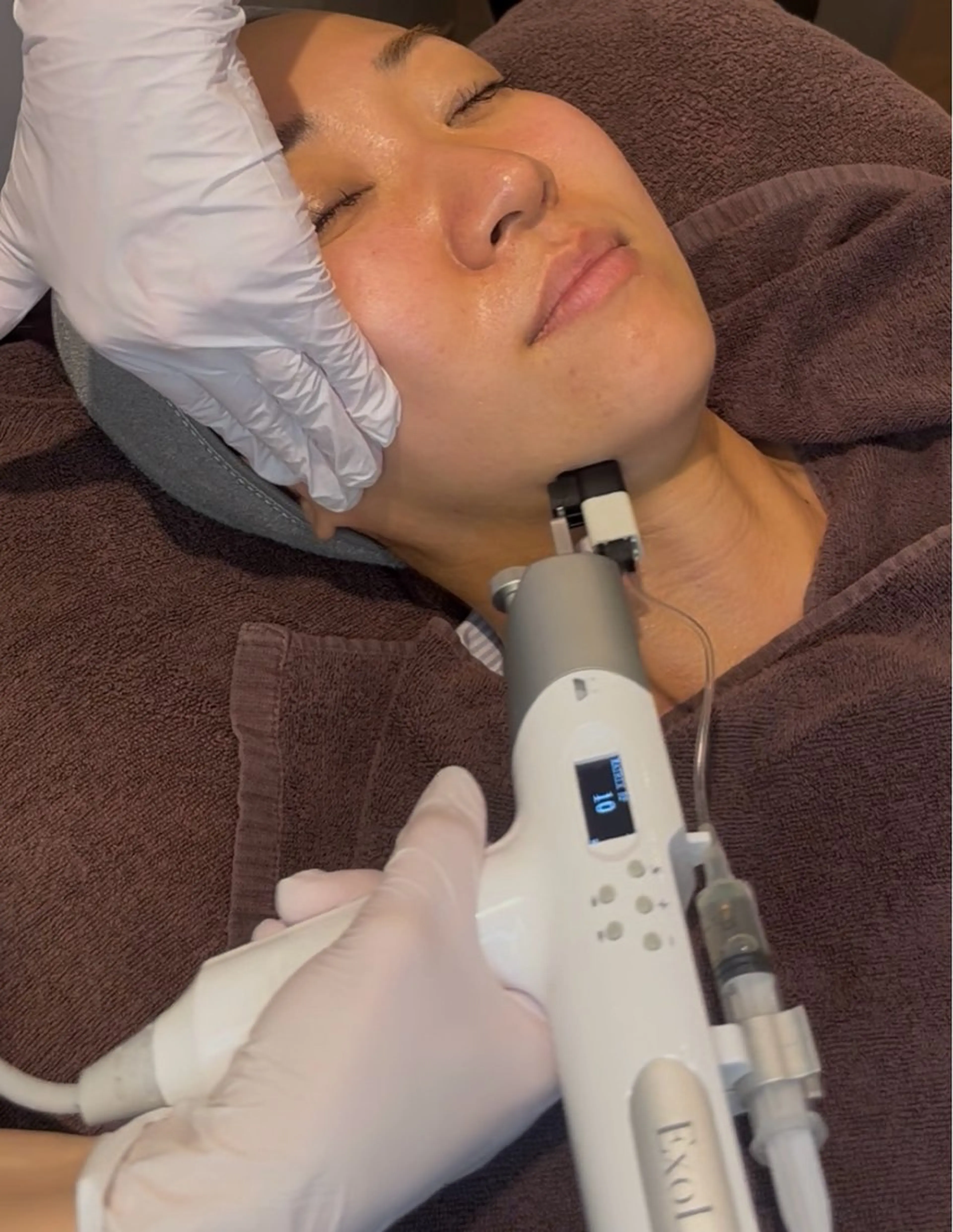 結局これが最強✨【ふっくらハリ！あれもこれも気になる貴方に❤️‍🔥】マシンで高純度ヒト幹細胞培養液の導入🧪初回破格✨の写真