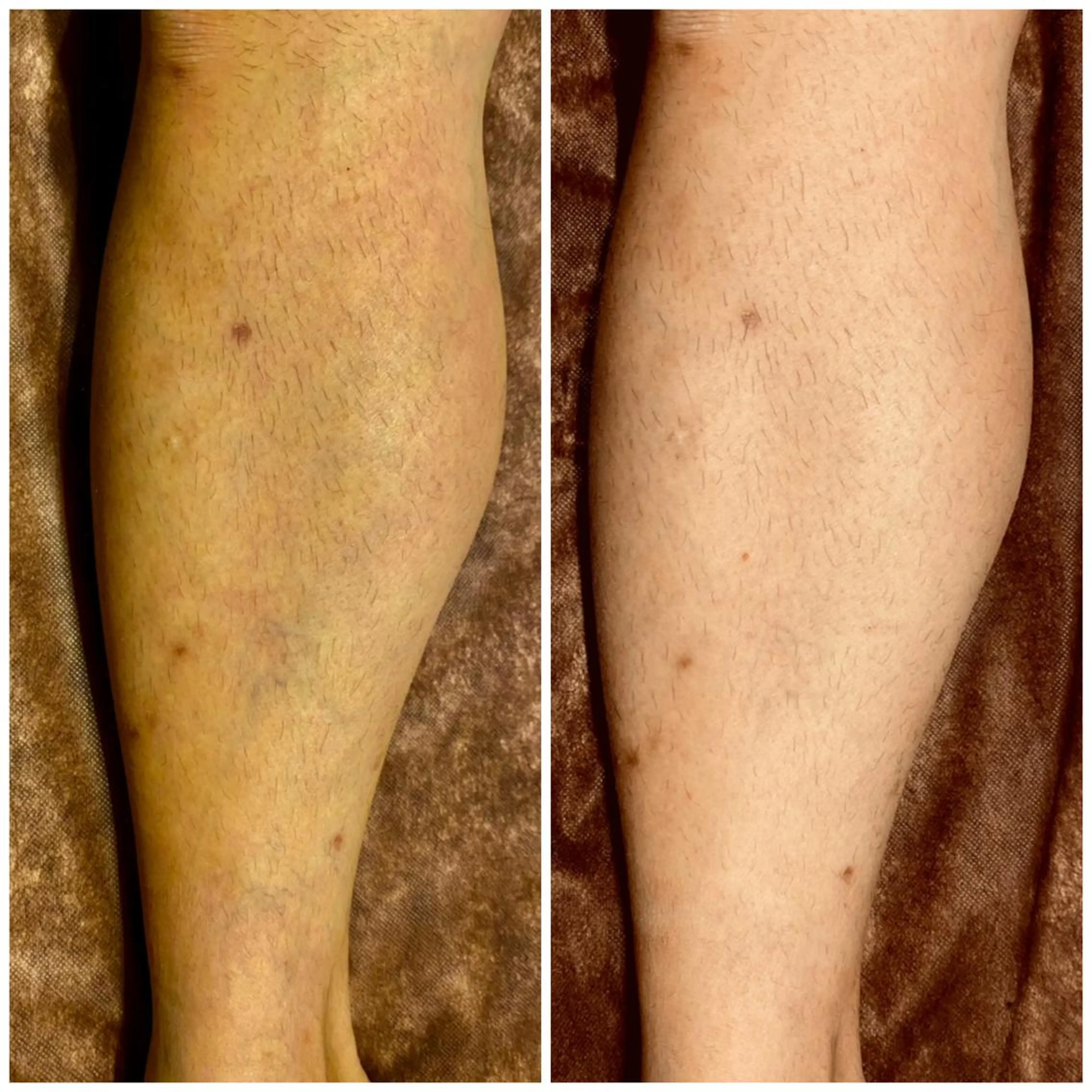 プルケル スパのエステ・リラクイメージ