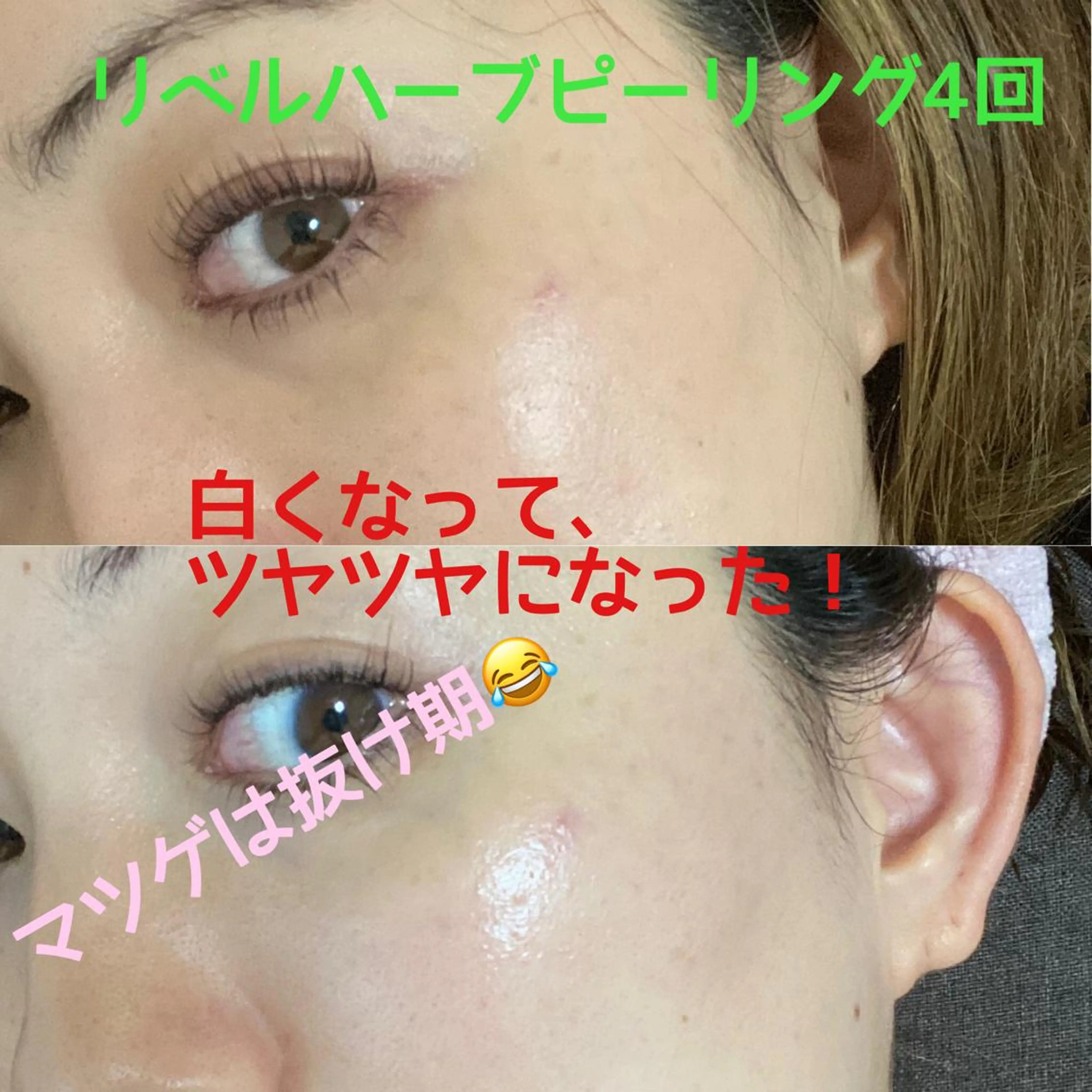 Rim リムのマツエク・マツパデザイン