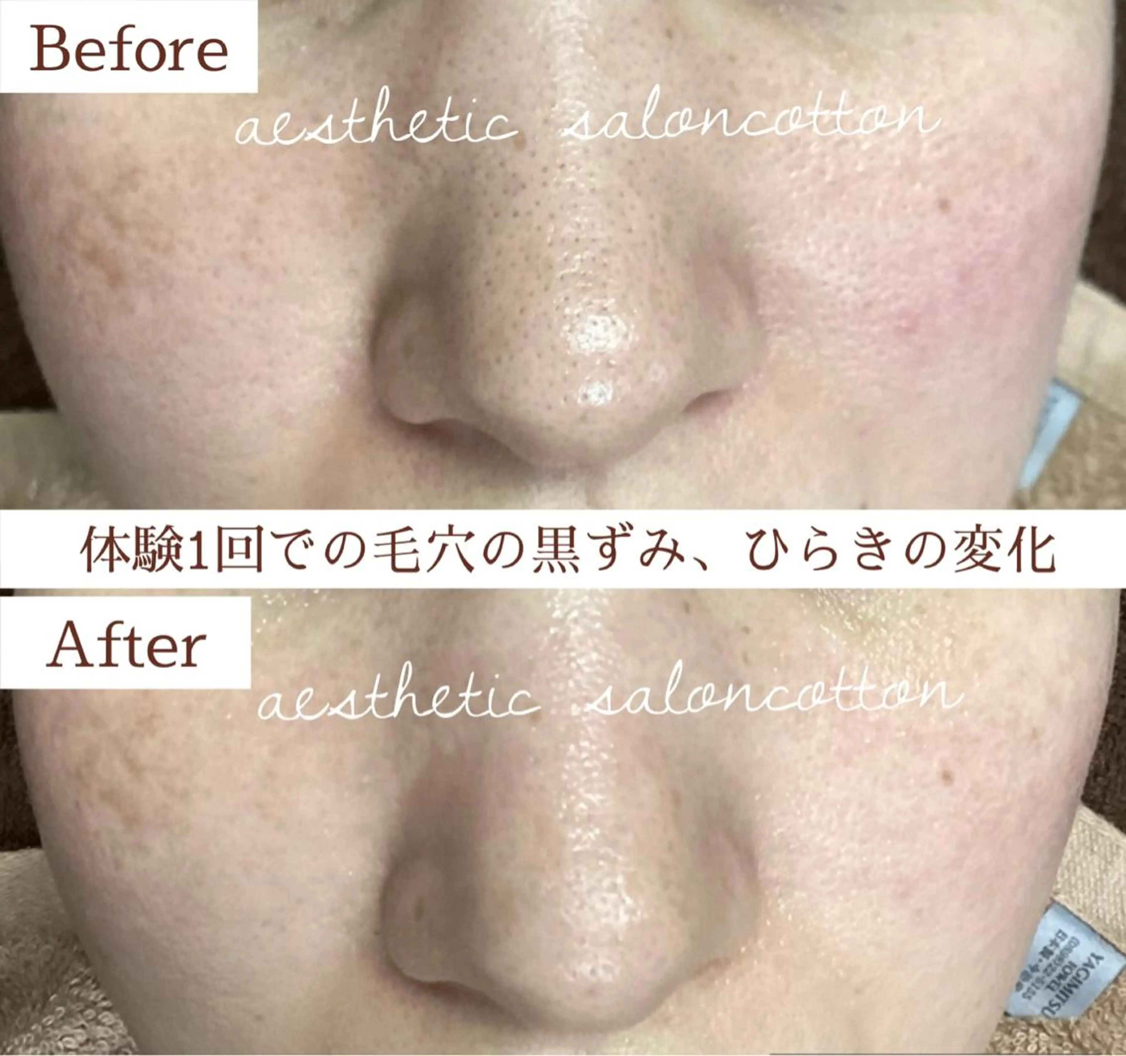 都度払い 肌質改善専門サロンのエステ・リラクイメージ