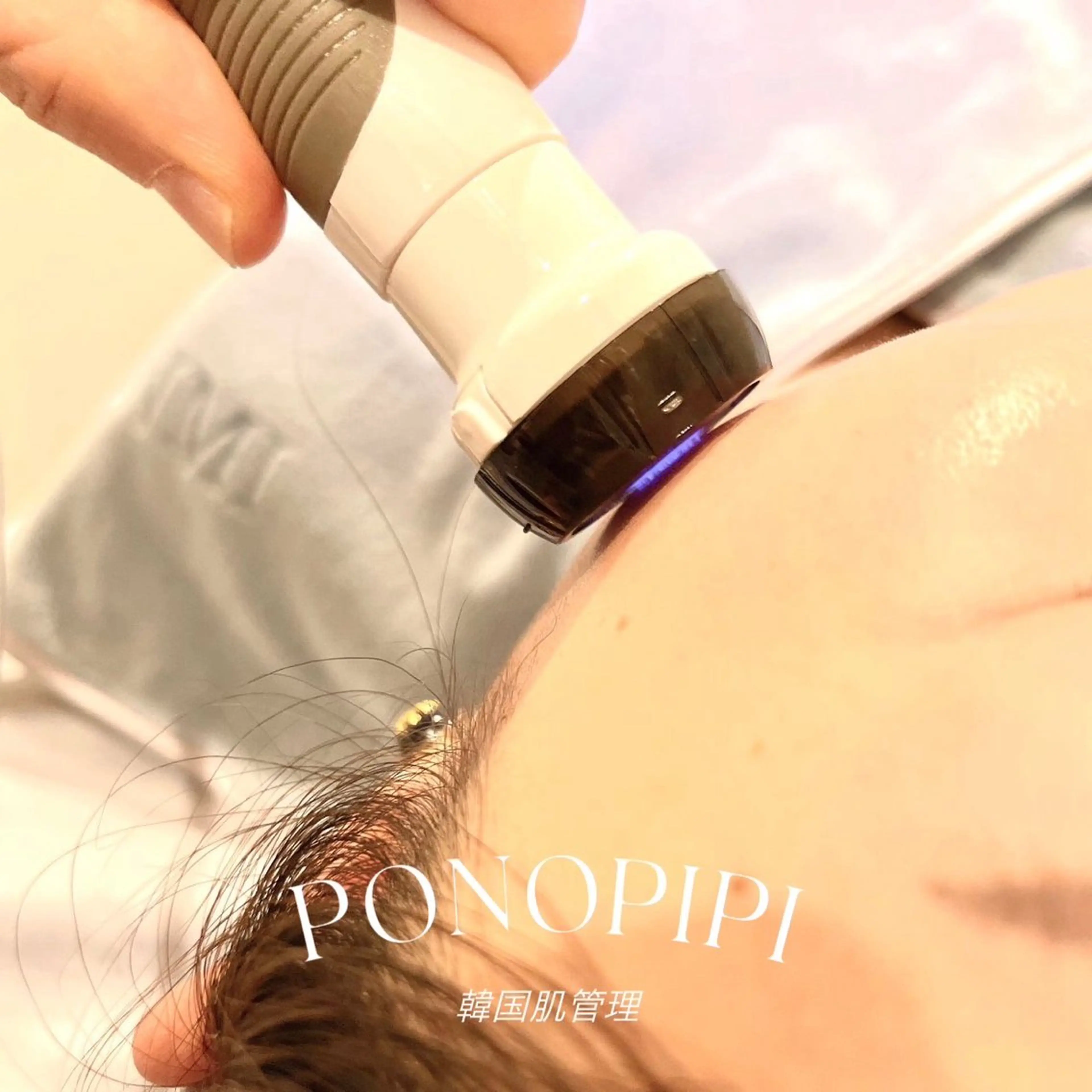 【毛穴ケア】プラズマ,顔筋マッサージ付毛穴洗浄☆ハイドロピーリング♪の写真