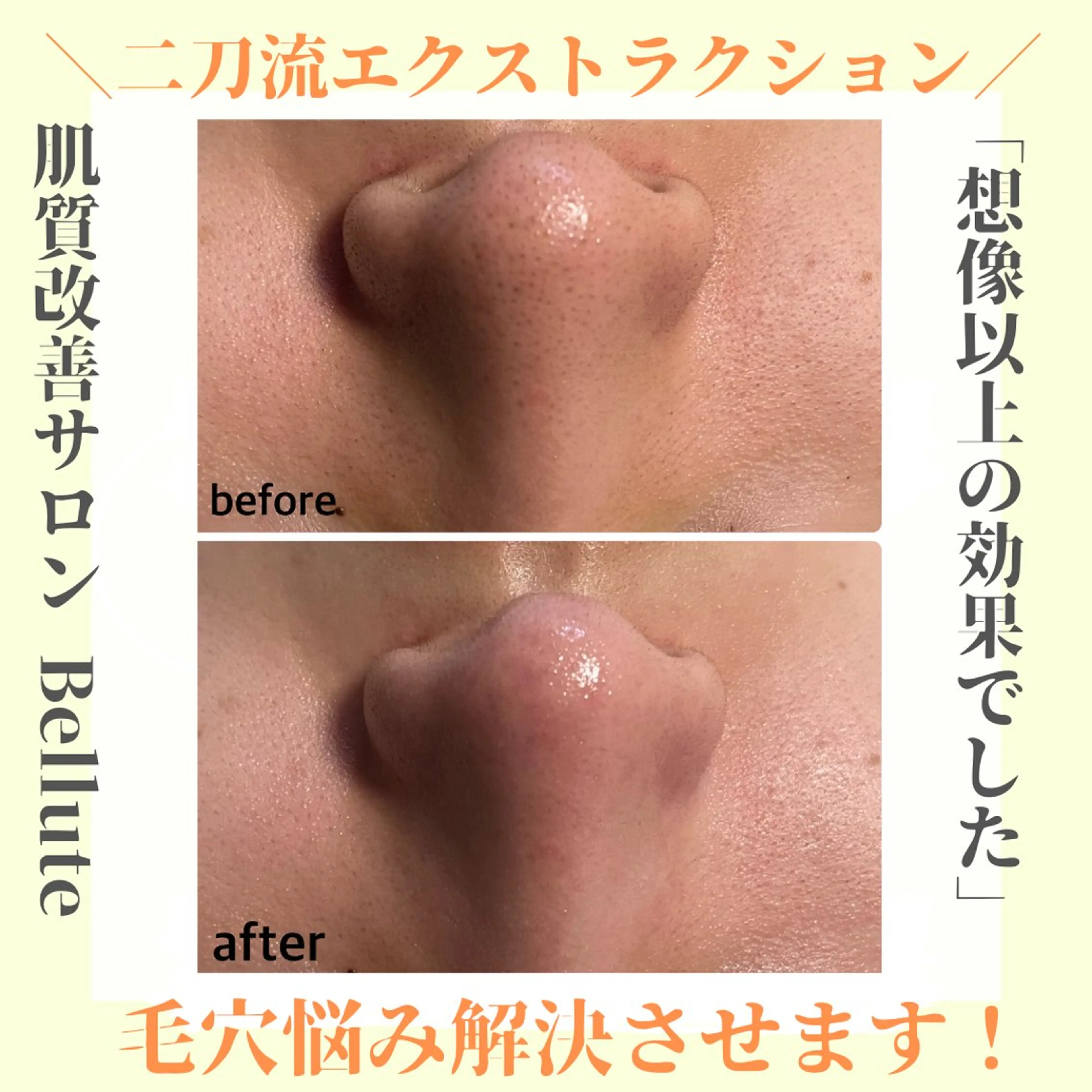 ピーリング専門店 Belluteのエステ・リラクイメージ