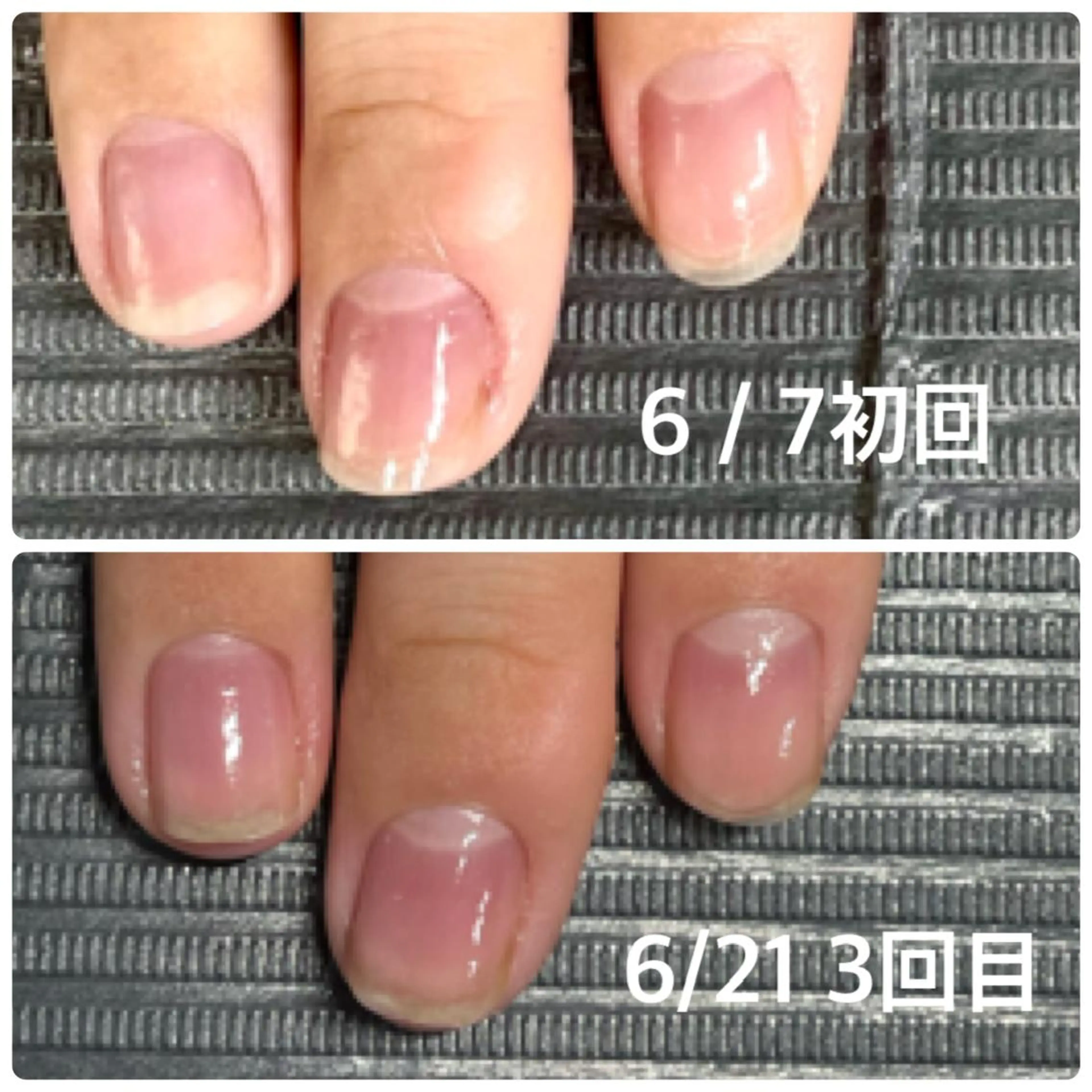 ネイル 奥園 良恵のネイルデザイン