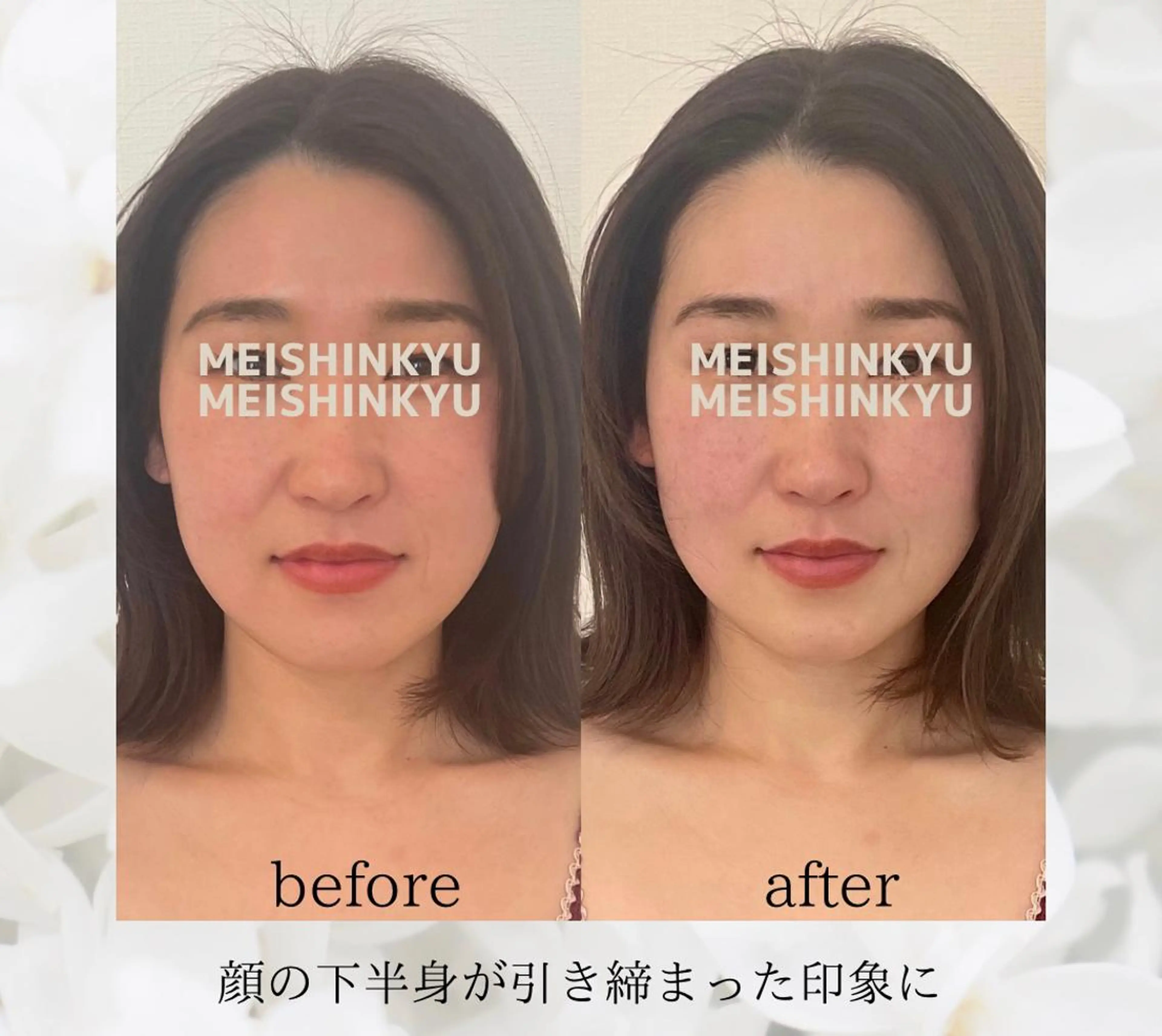 meishinkyu所属・小顔矯正  小林 香織のエステ・リラクイメージ