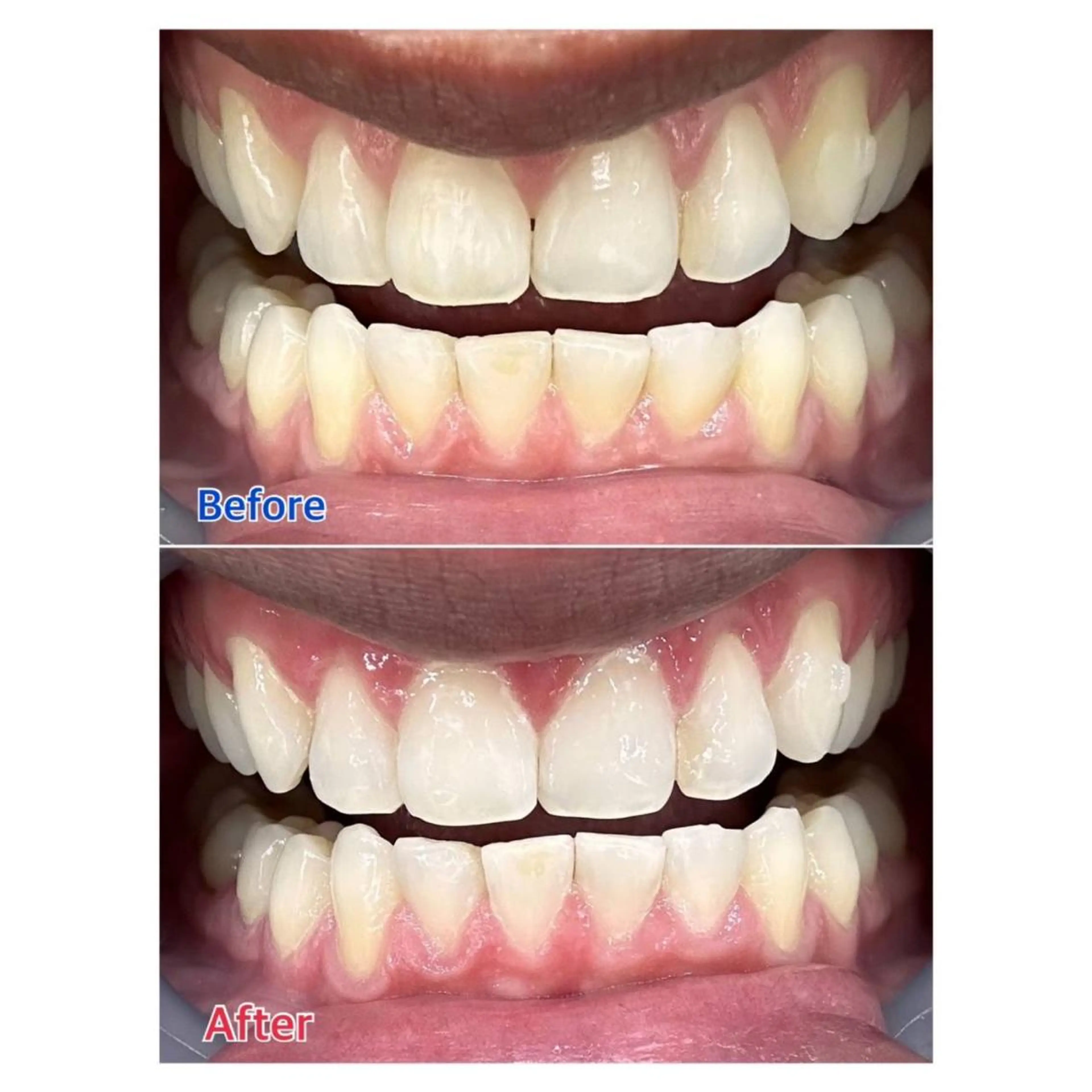 MBEAUTYSALON 千葉店・京成大久保所属・Melty 輝のその他イメージ