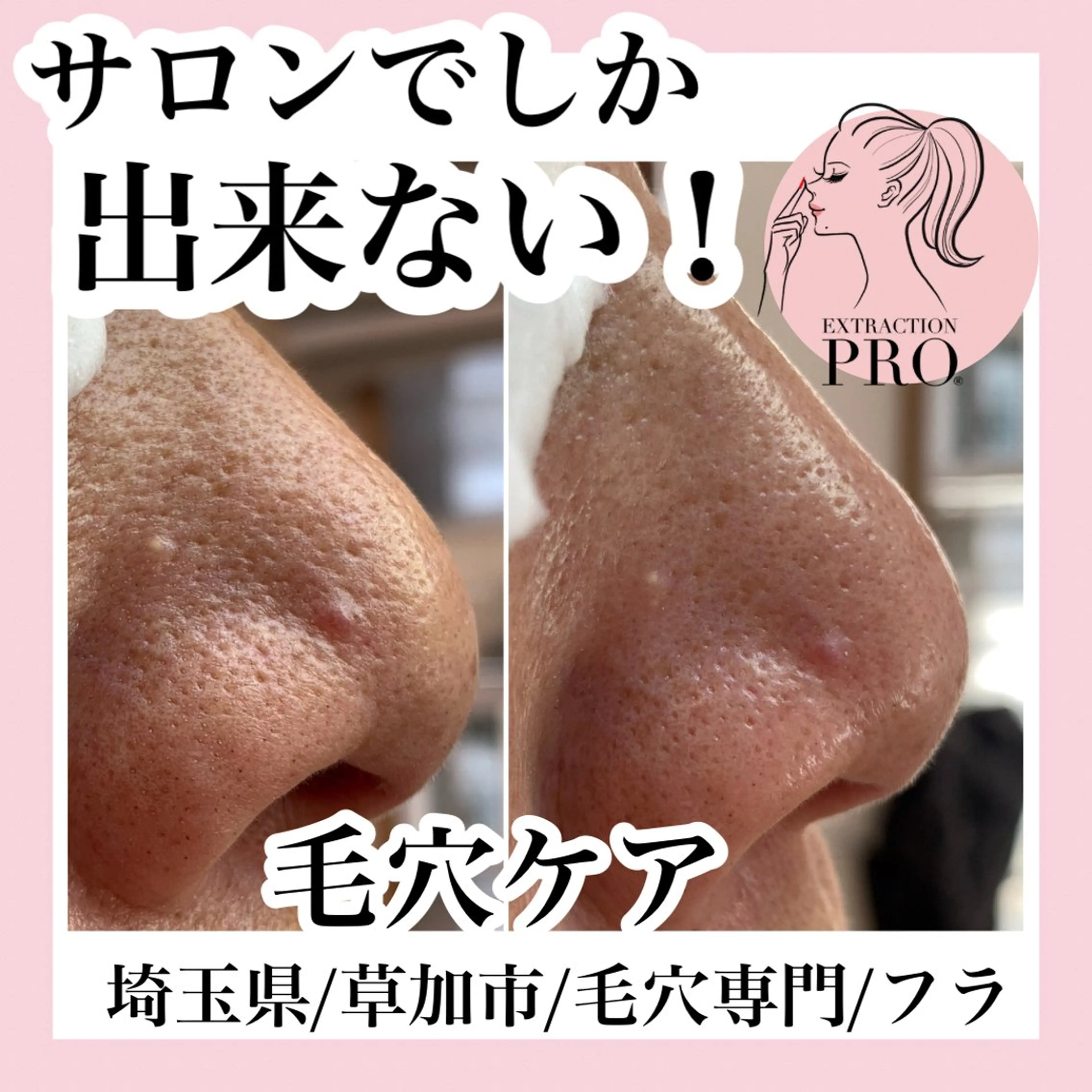 エステ 毛穴専門店hula 杉山智美のエステ・リラクイメージ