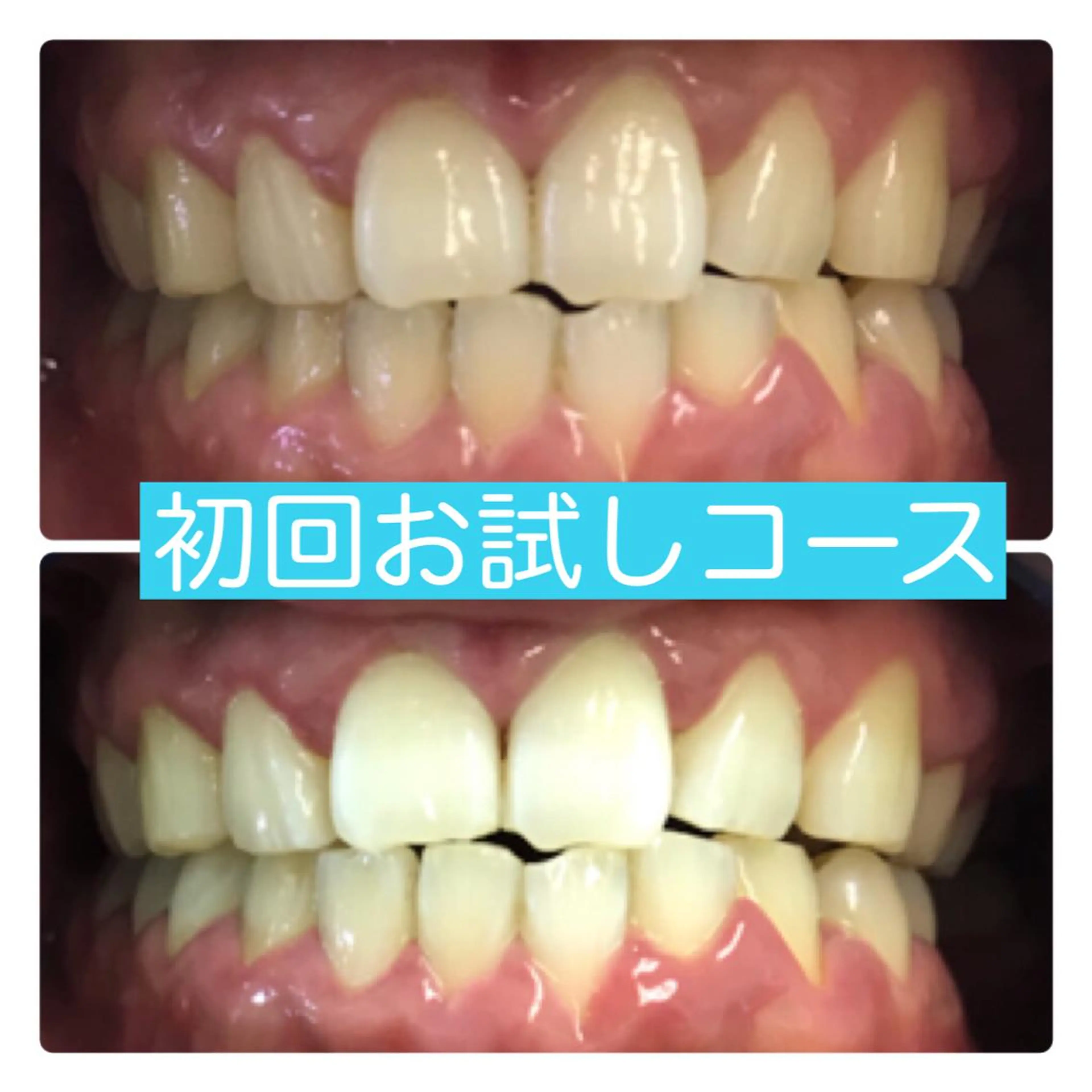 PLATINUM Beauty 横浜店所属・ホワイトニングルーム 横浜店のその他イメージ