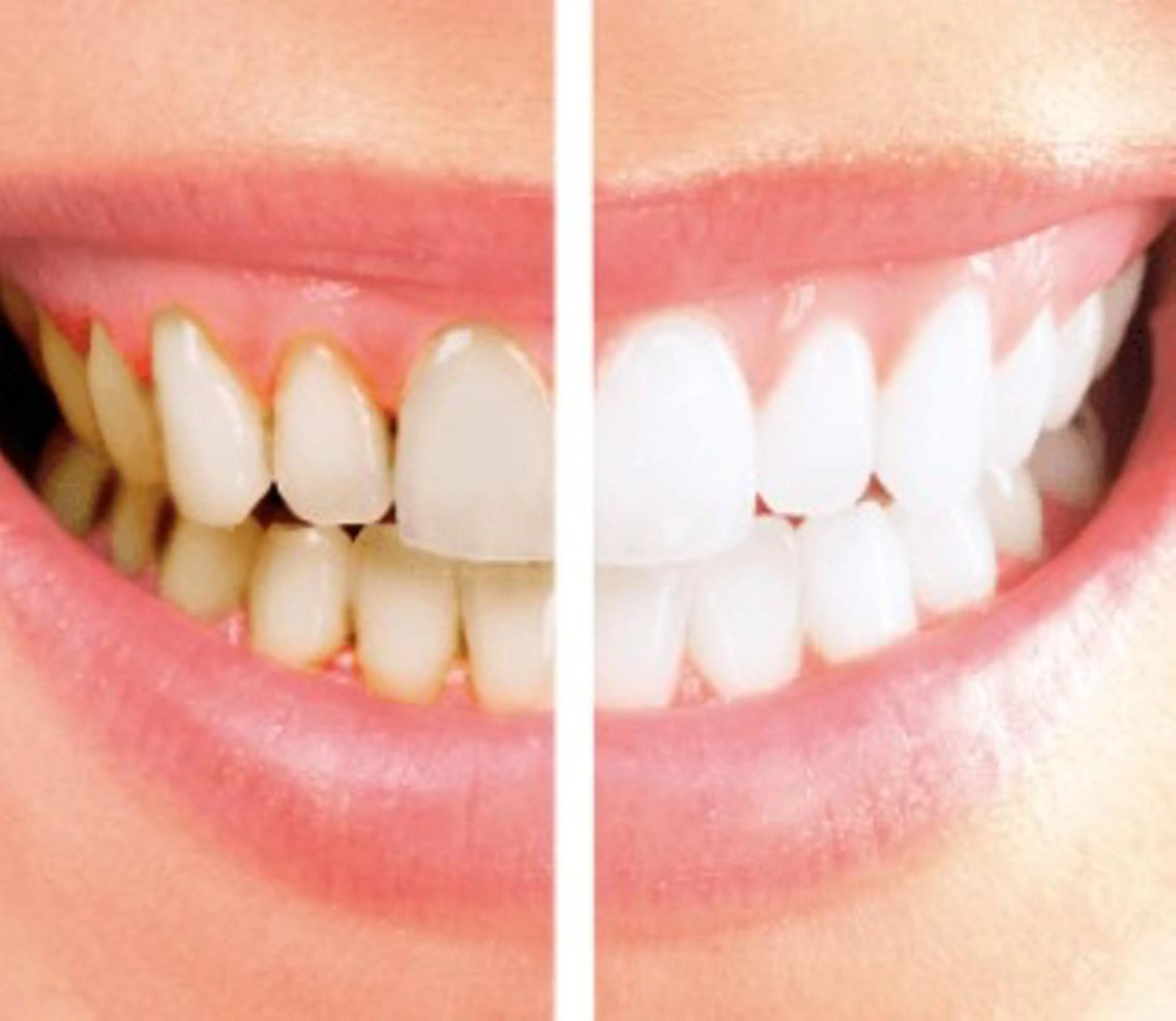 Totalbeautysalon Coco所属・Coco caoriのマツエク・マツパデザイン