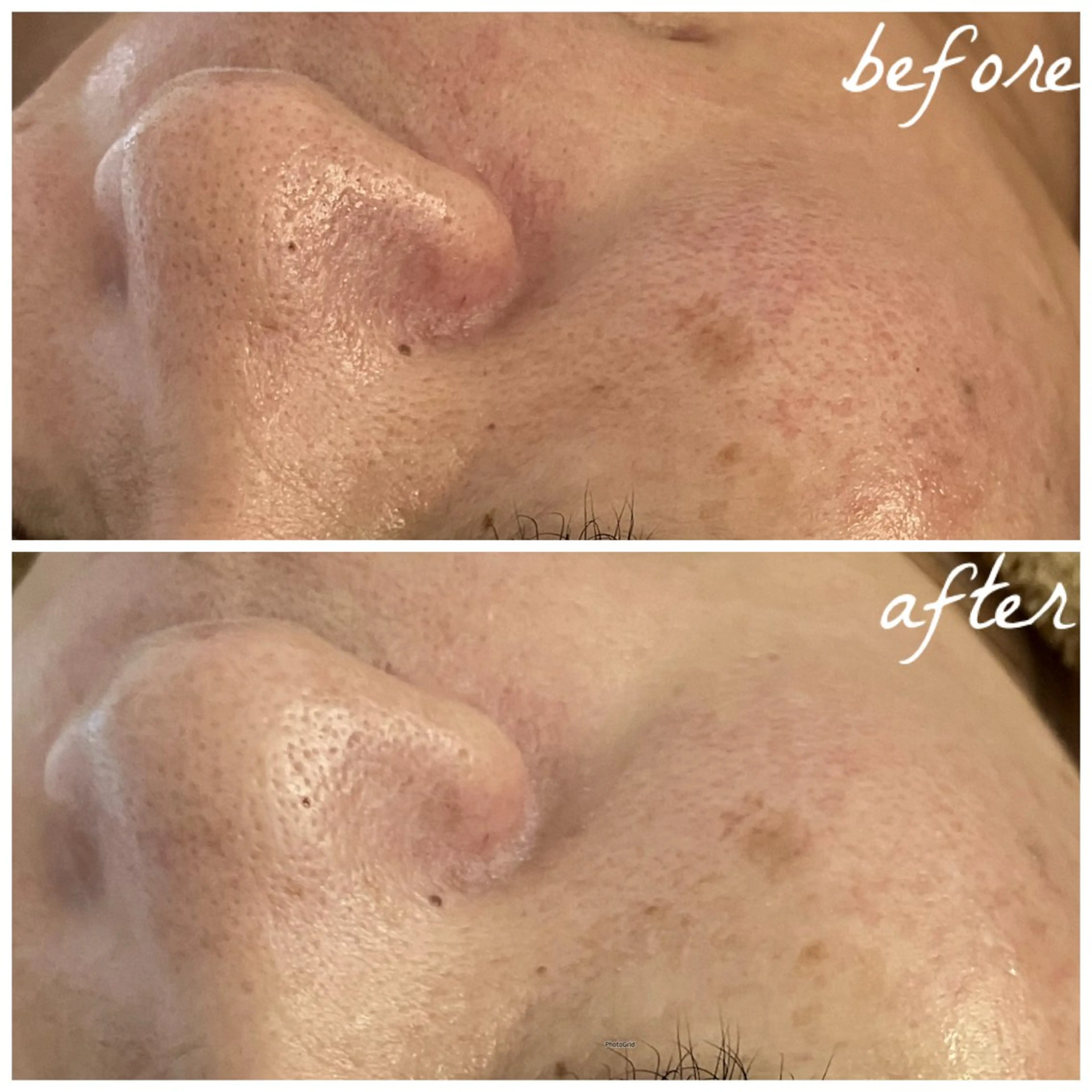 メンズ エステ メナード岐阜茜部 杉浦のエステ・リラクイメージ