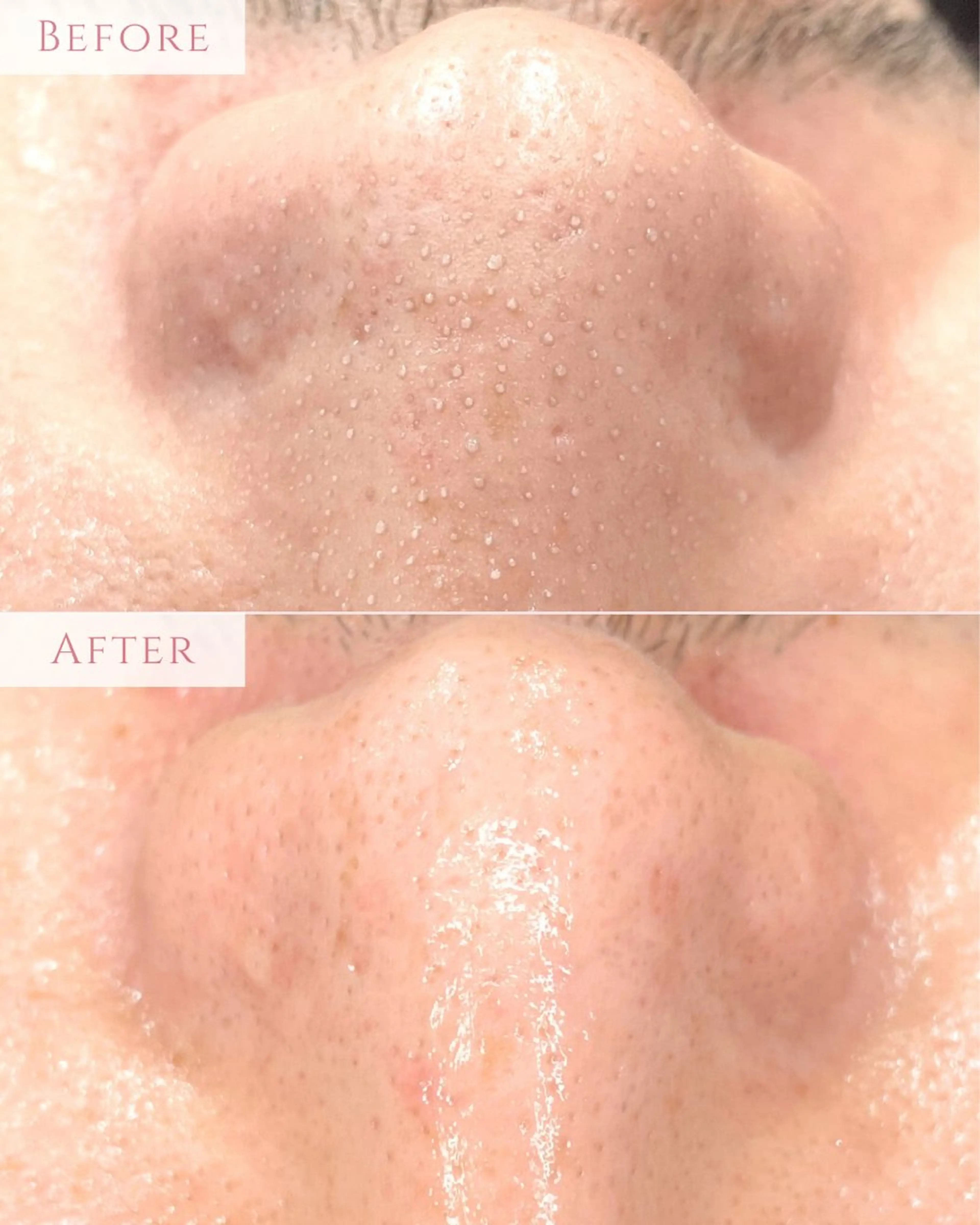 エステ 肌質改善専門サロン Bellmi/心斎橋のエステ・リラクイメージ