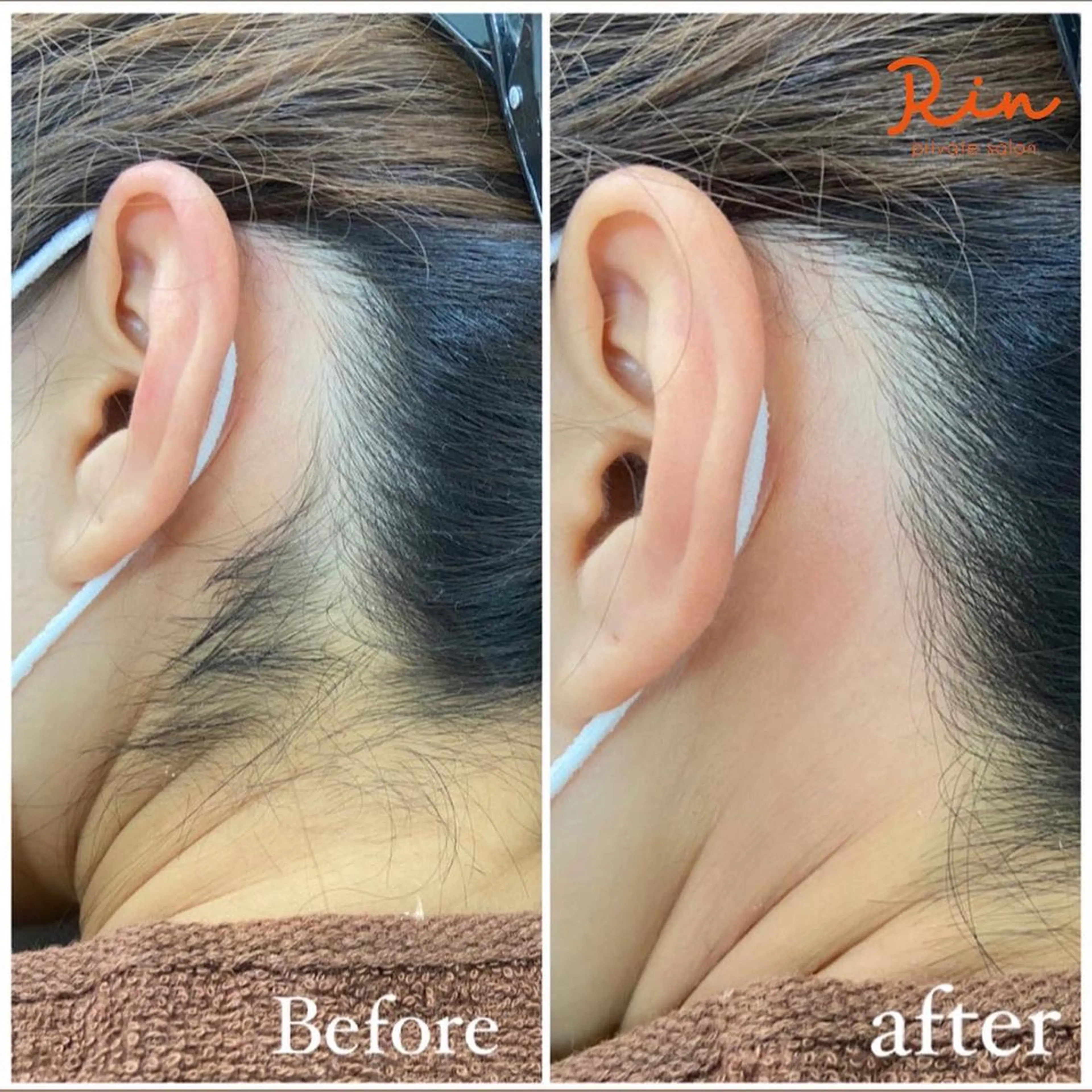 うなじWax脱毛（オーガニックWAX使用）の写真