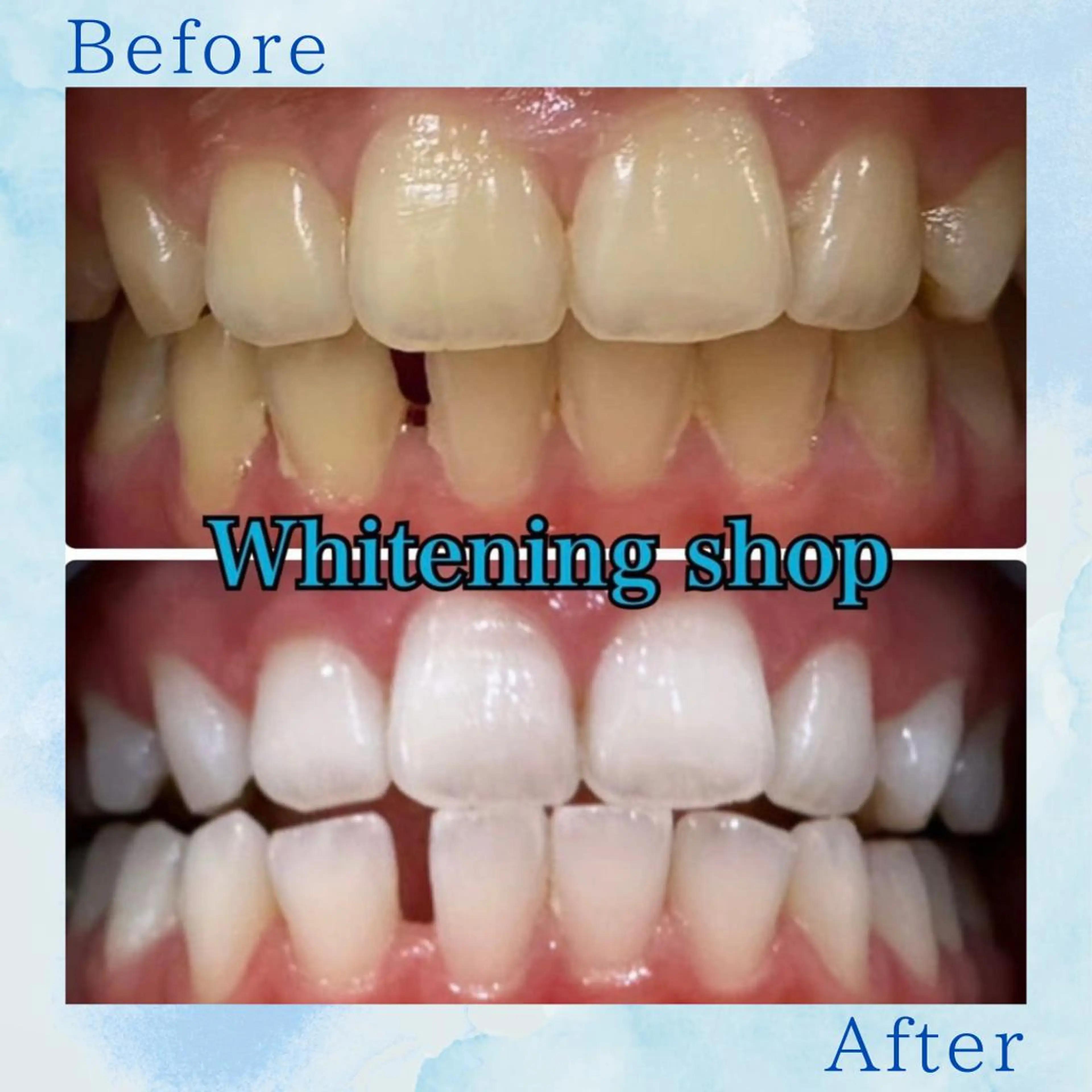 ホワイトニング ショップ葛西店のその他イメージ