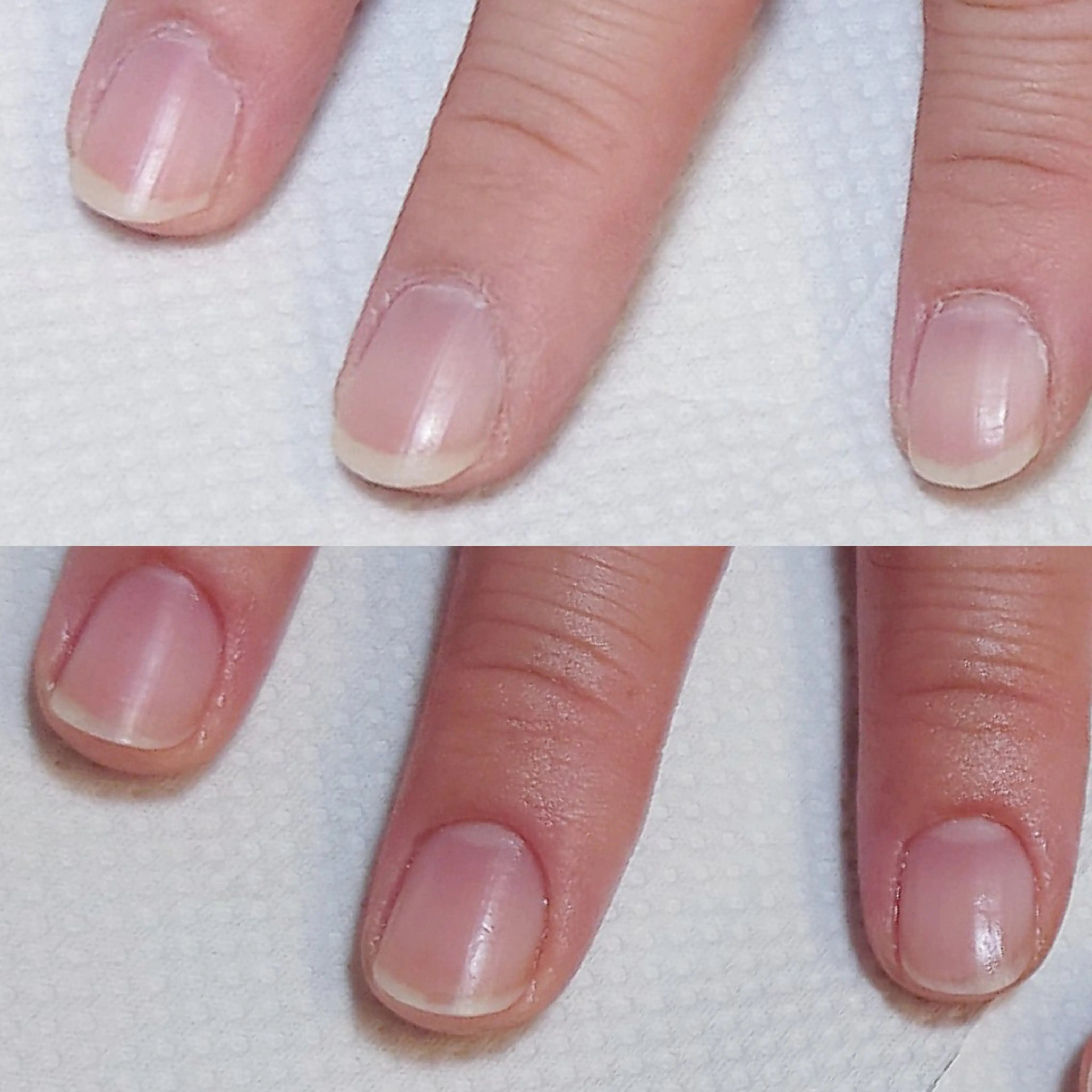 ネイル improve /mamiのネイルデザイン