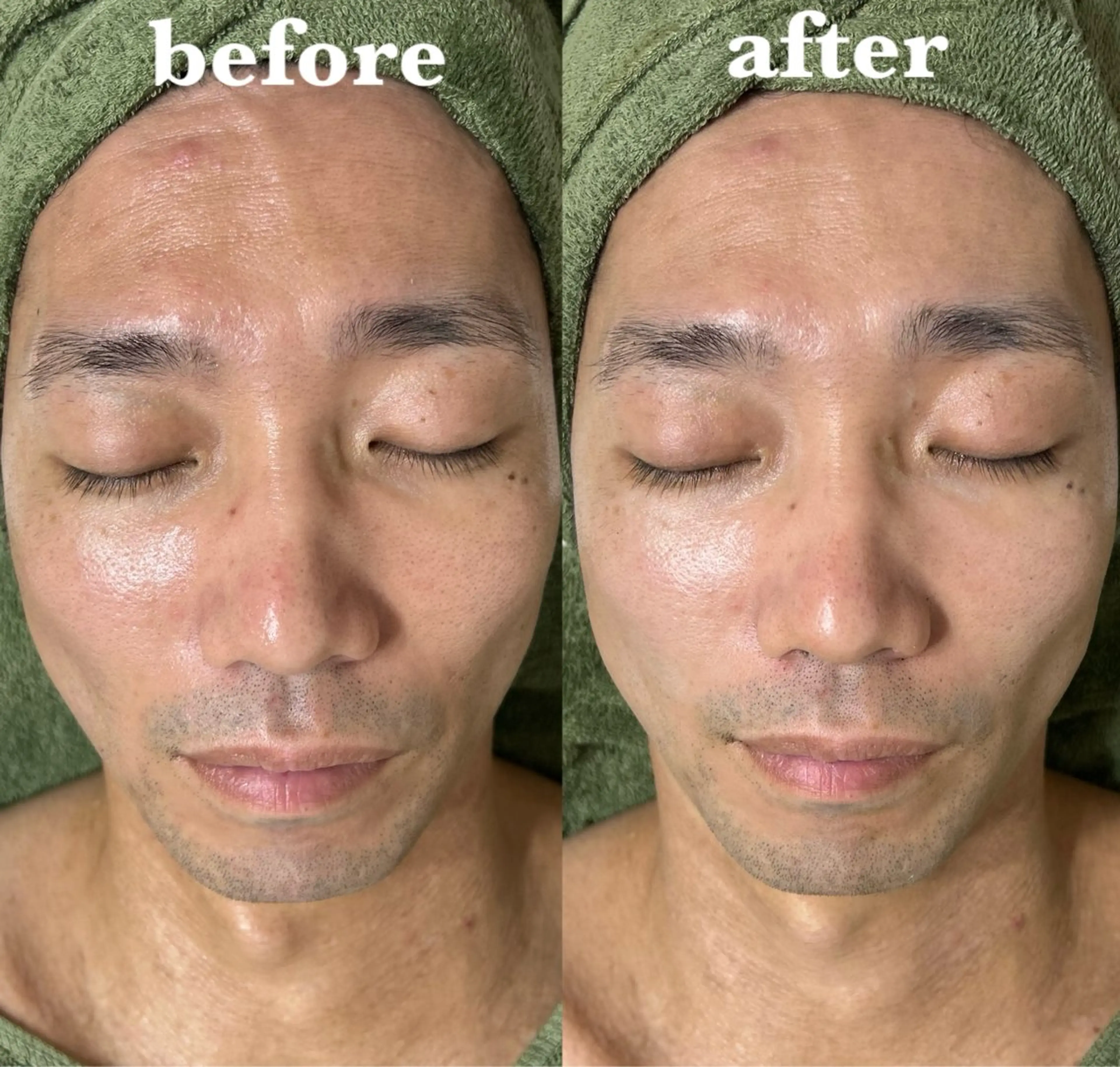 メンズ 【肌質改善サロン】 リーフィアのエステ・リラクイメージ