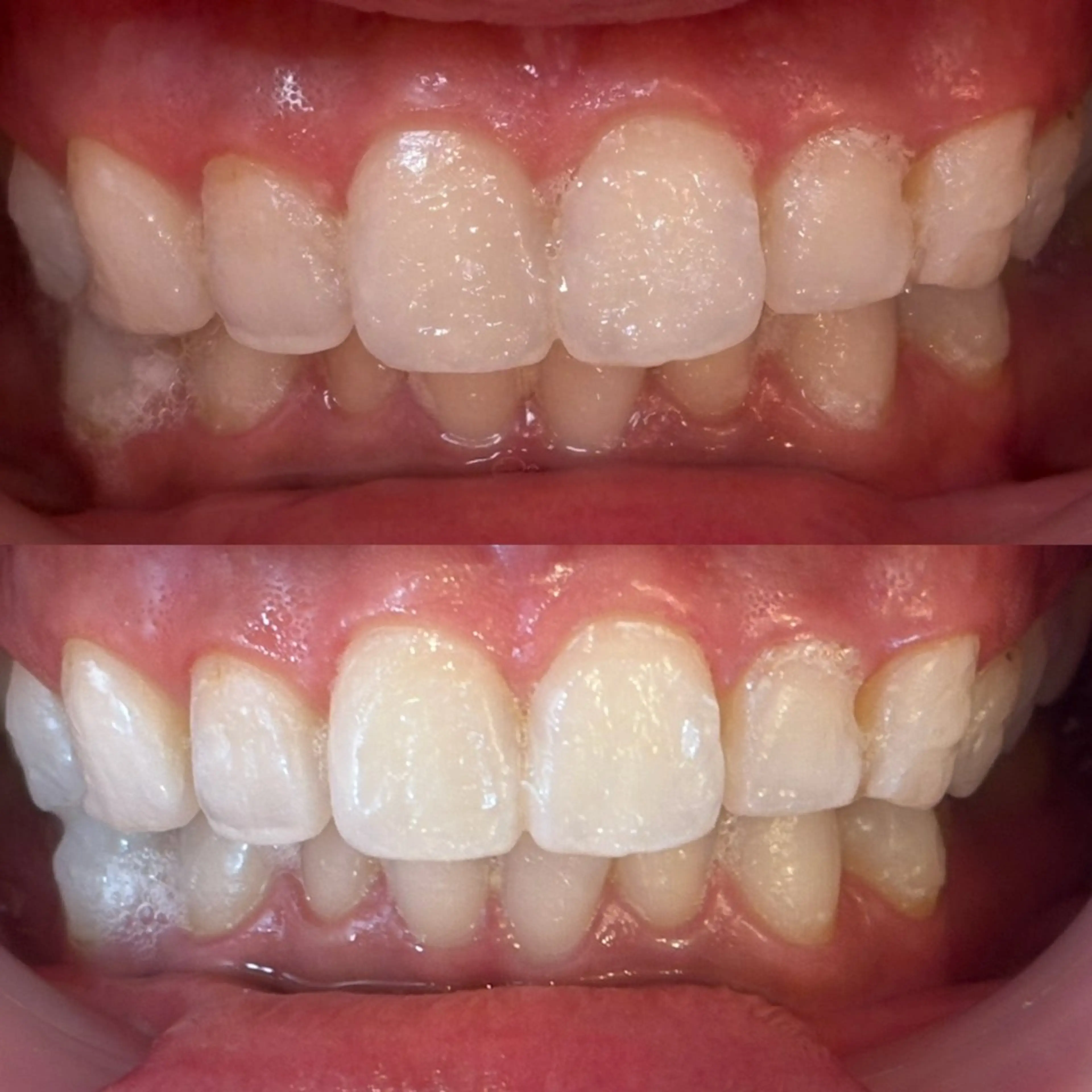 その他 CHARMER 韓国式美肌サロンの眉毛・アイブロウイメージ