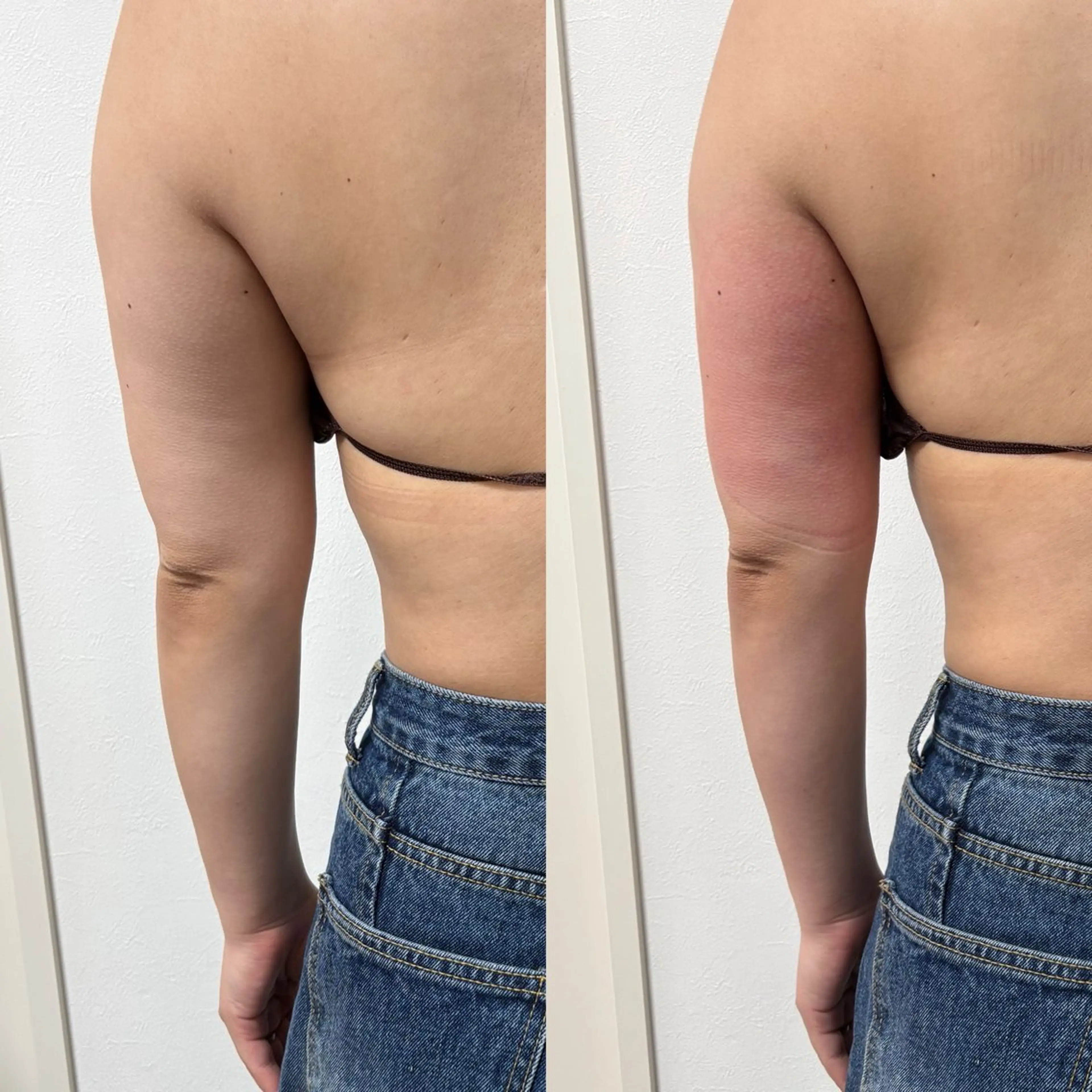 Miiju.所属・Miiju. 石巻市 脂肪冷却  鈴木のエステ・リラクイメージ