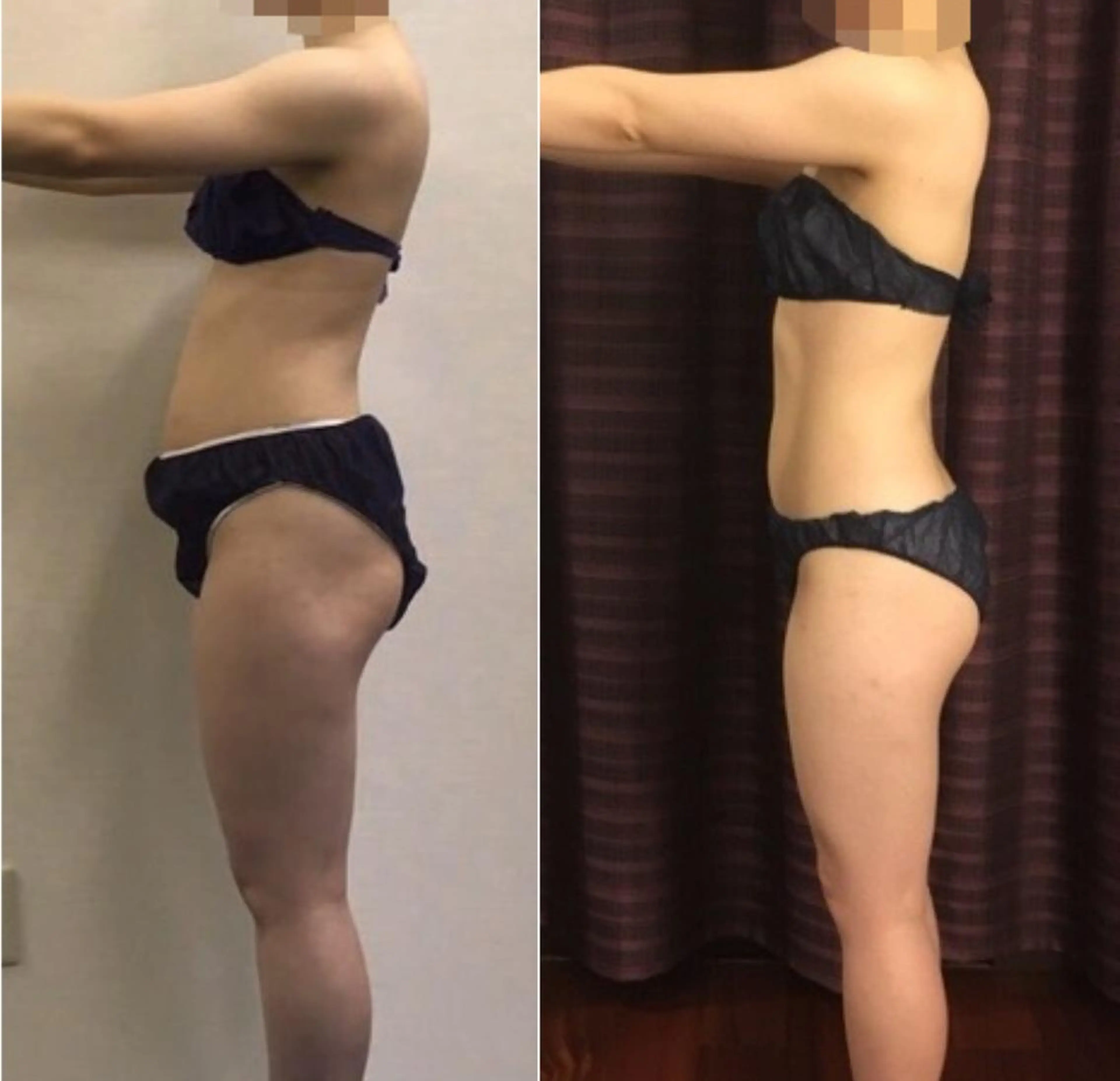 リンパダイエット180分【リンパ太り解消】33000円→25000円　足痩せ・背中痩せ・美尻・小顔の写真