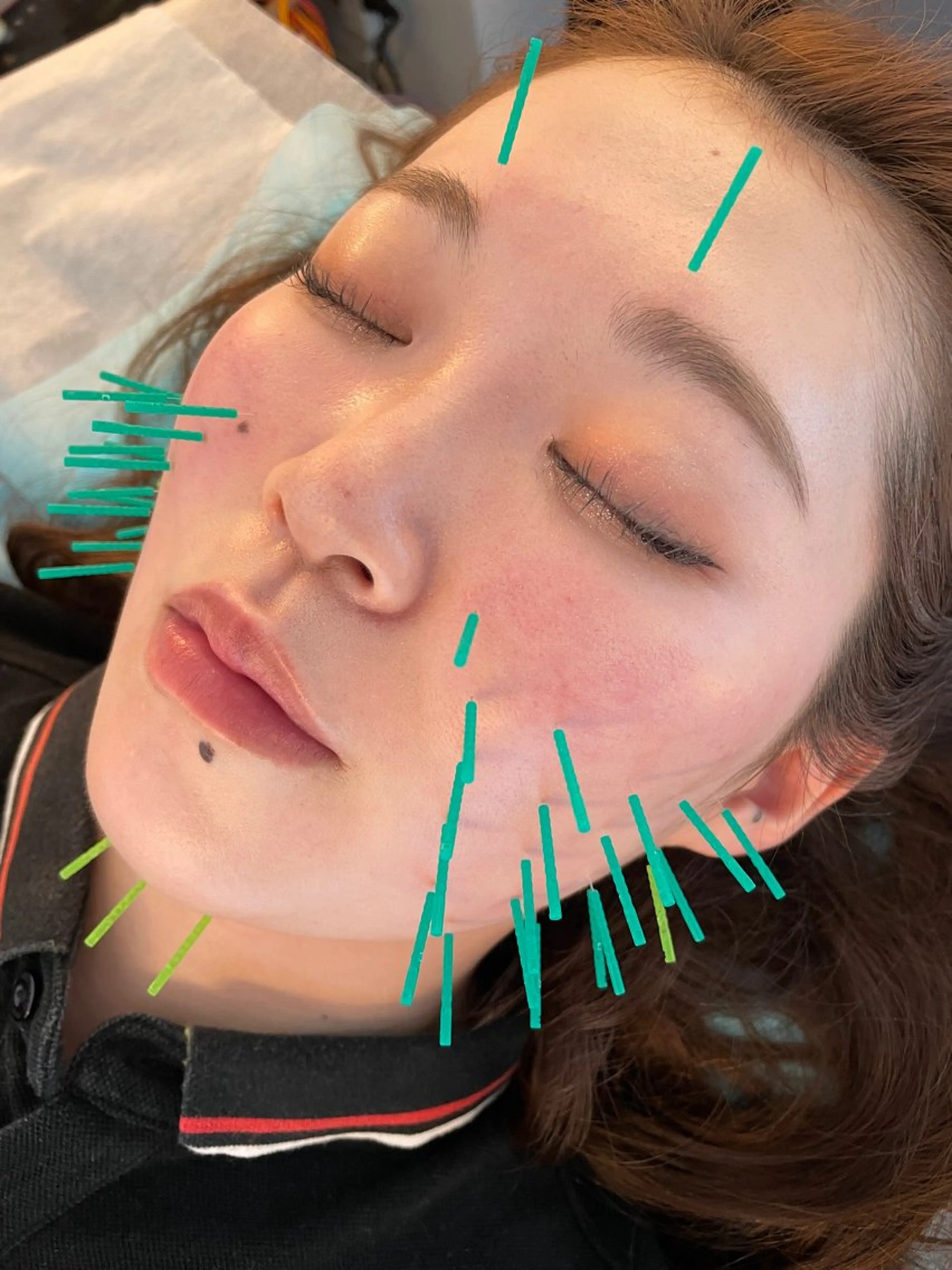 小顔美容鍼専門サロン 渋谷YZのエステ・リラクイメージ