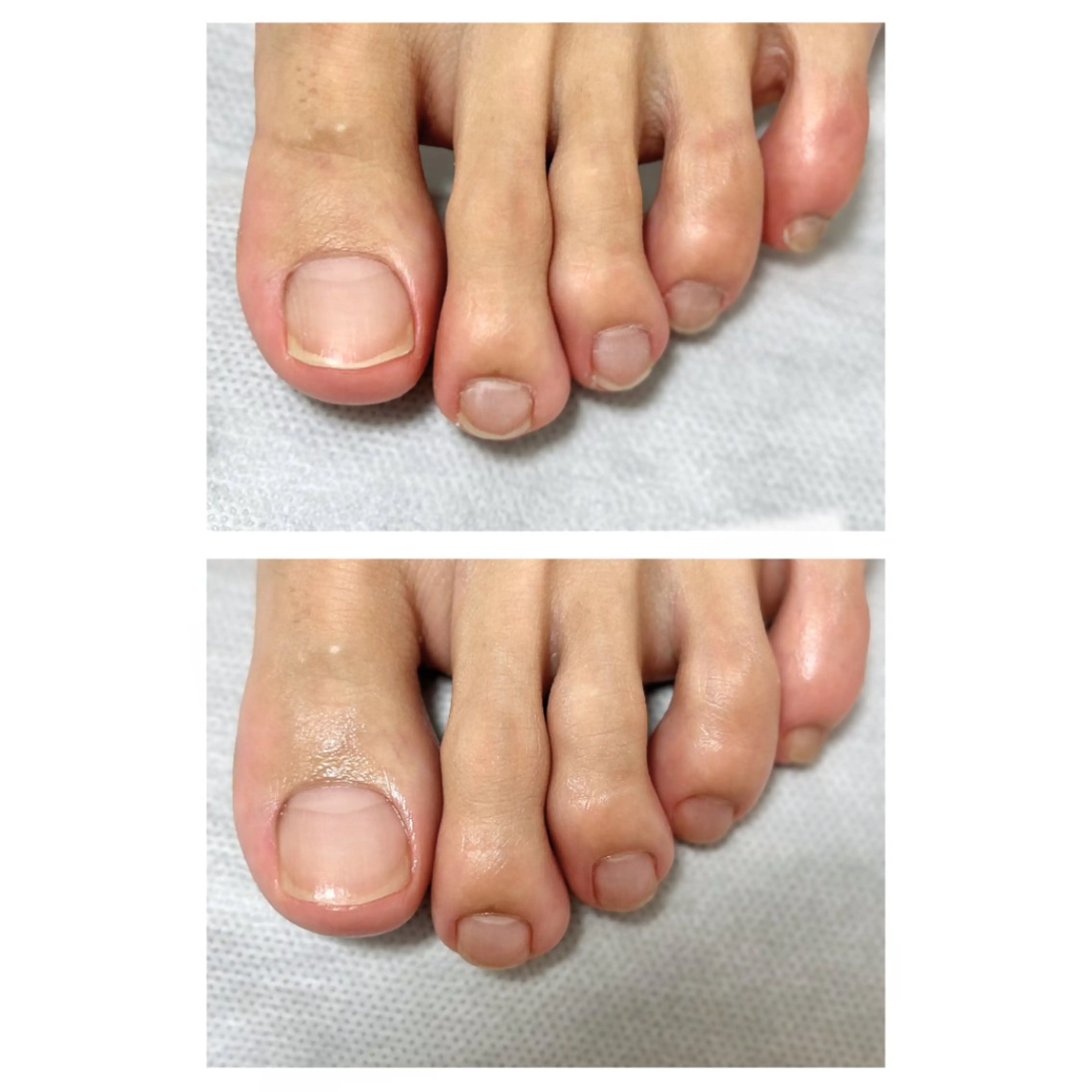 その他 なが さきのネイルデザイン