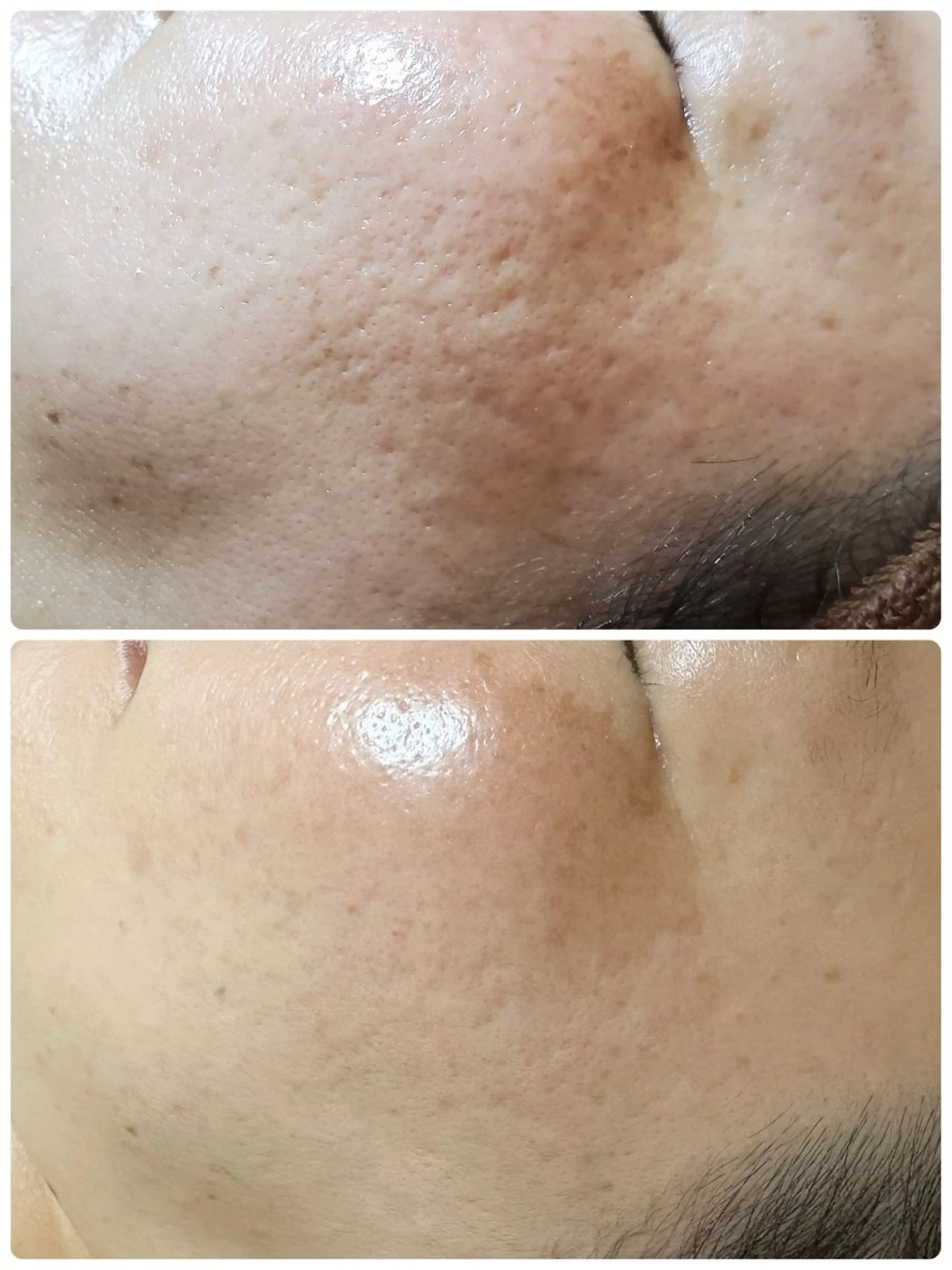 エステ トバル ユリコのエステ・リラクイメージ