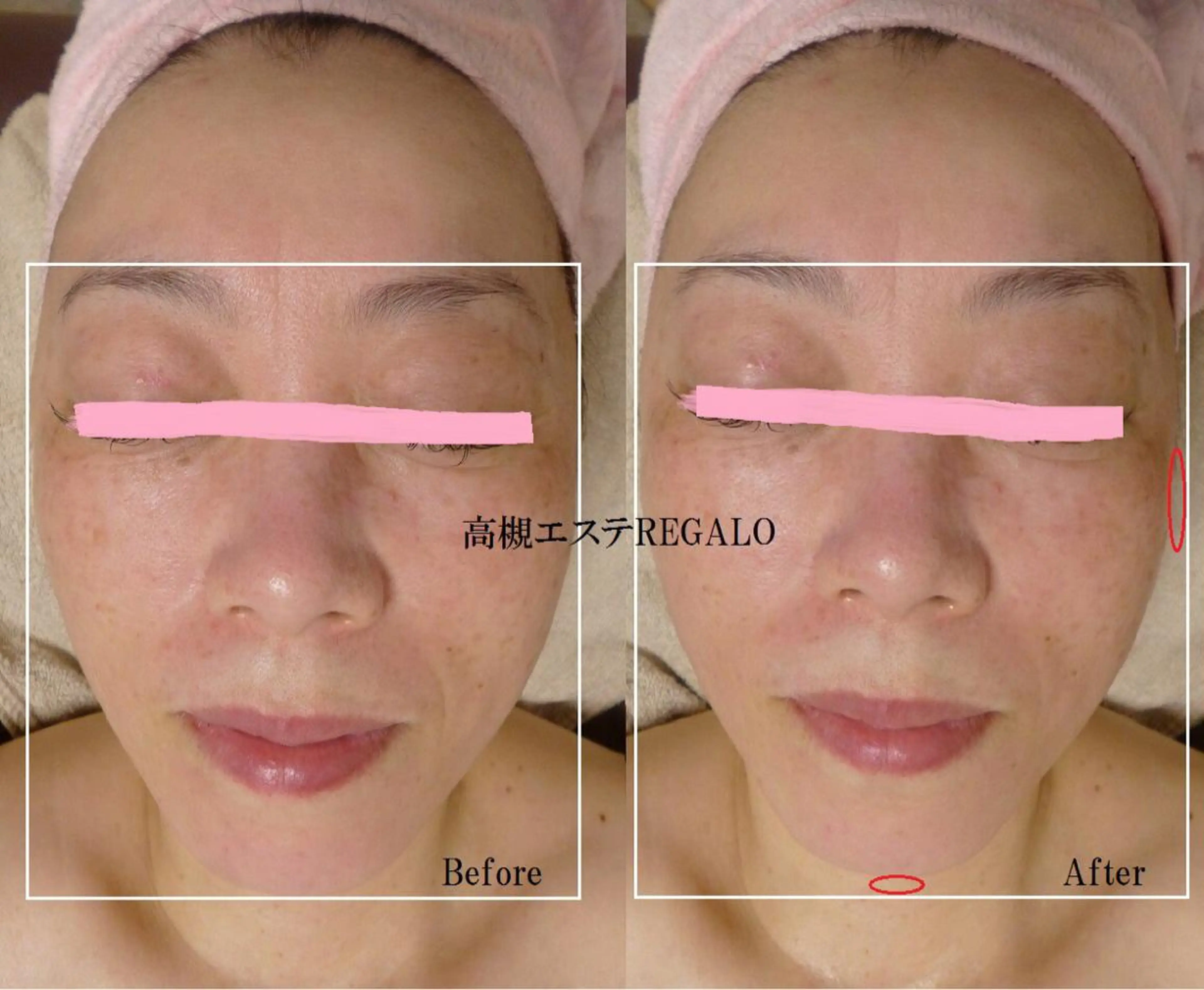 エステ REGALO所属・矢野 さやかのエステ・リラクイメージ