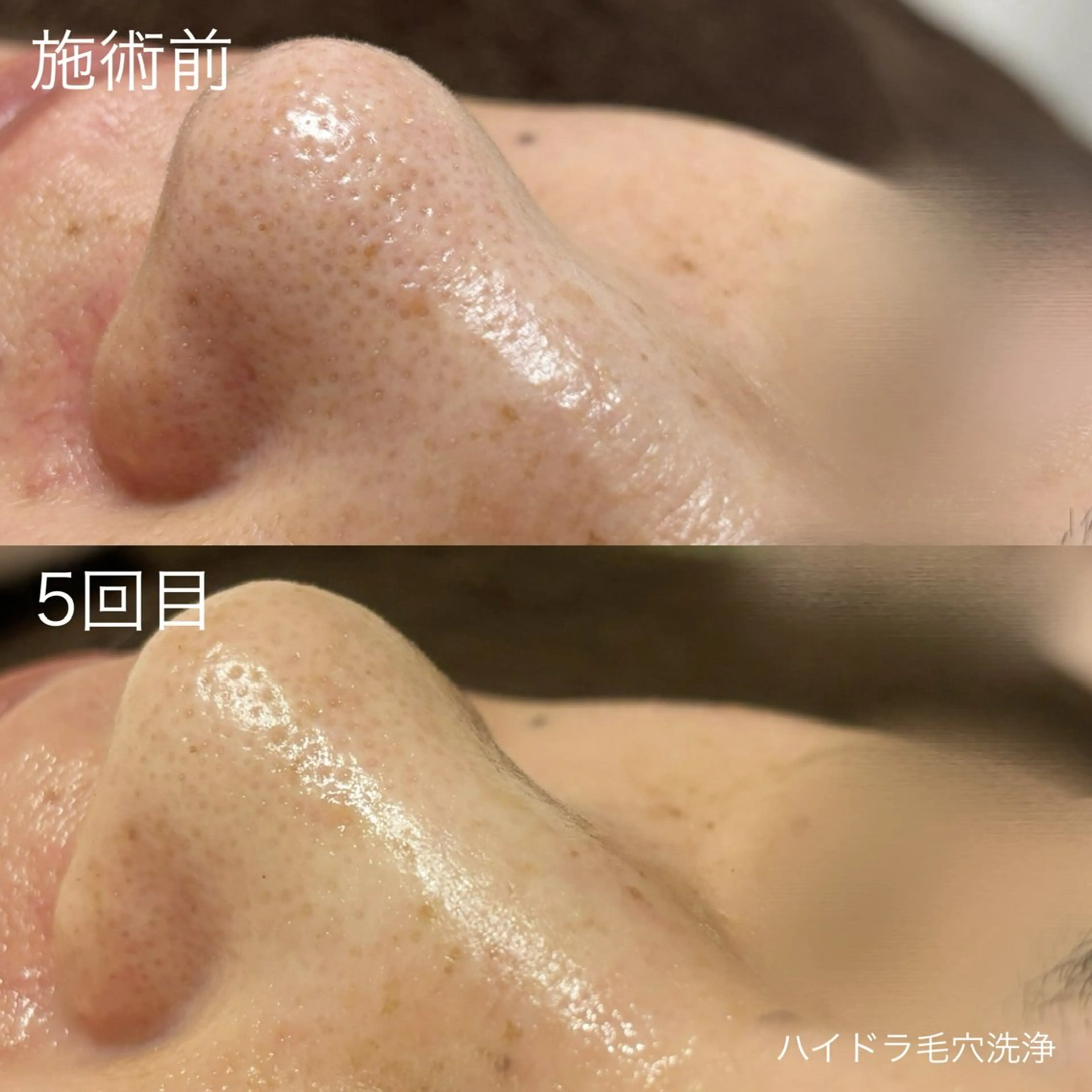 脱毛 lulularico Yuのエステ・リラクイメージ