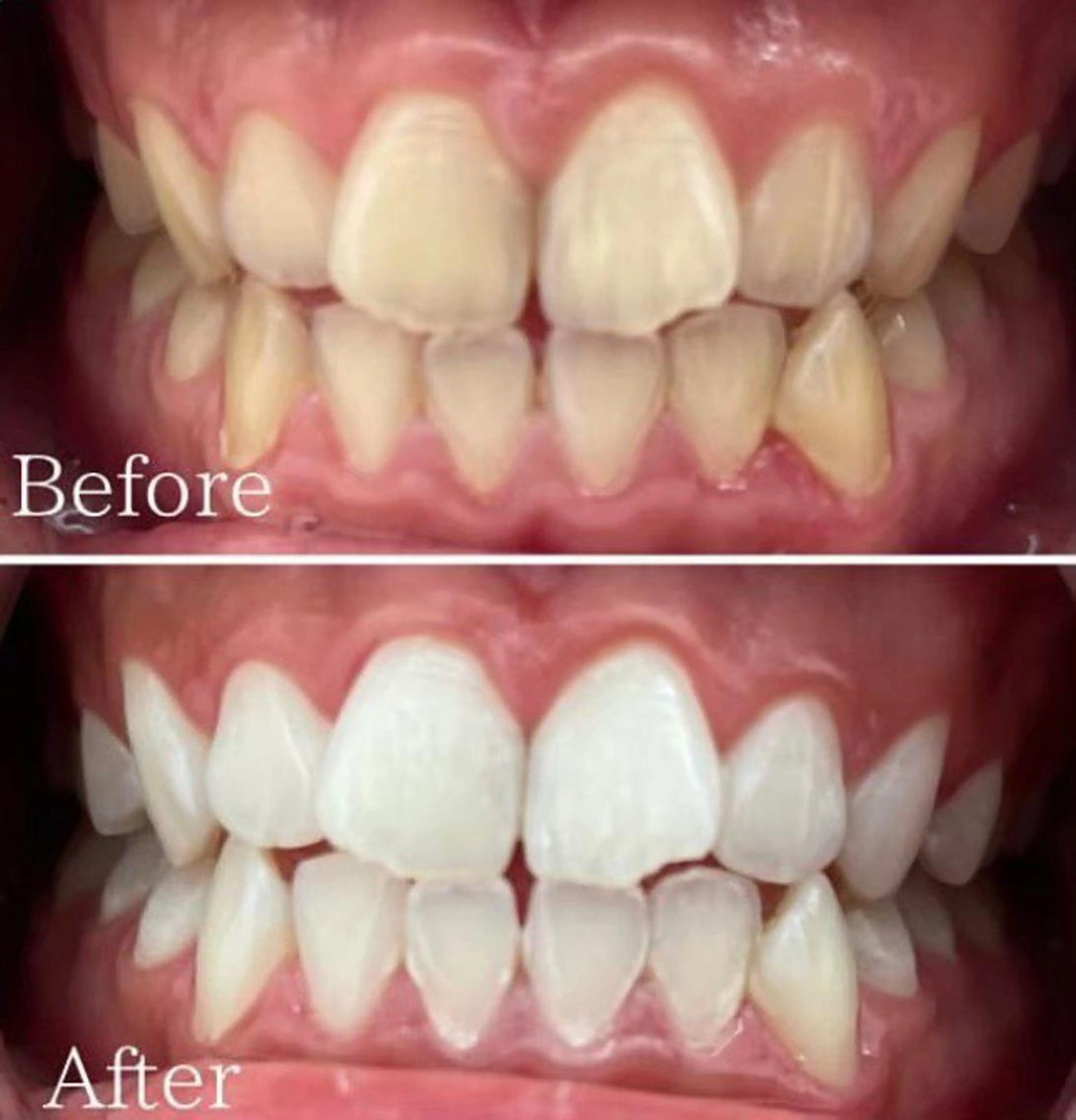 メンズ その他 ホワイトニング専門店 WHITE天神店のエステ・リラクイメージ