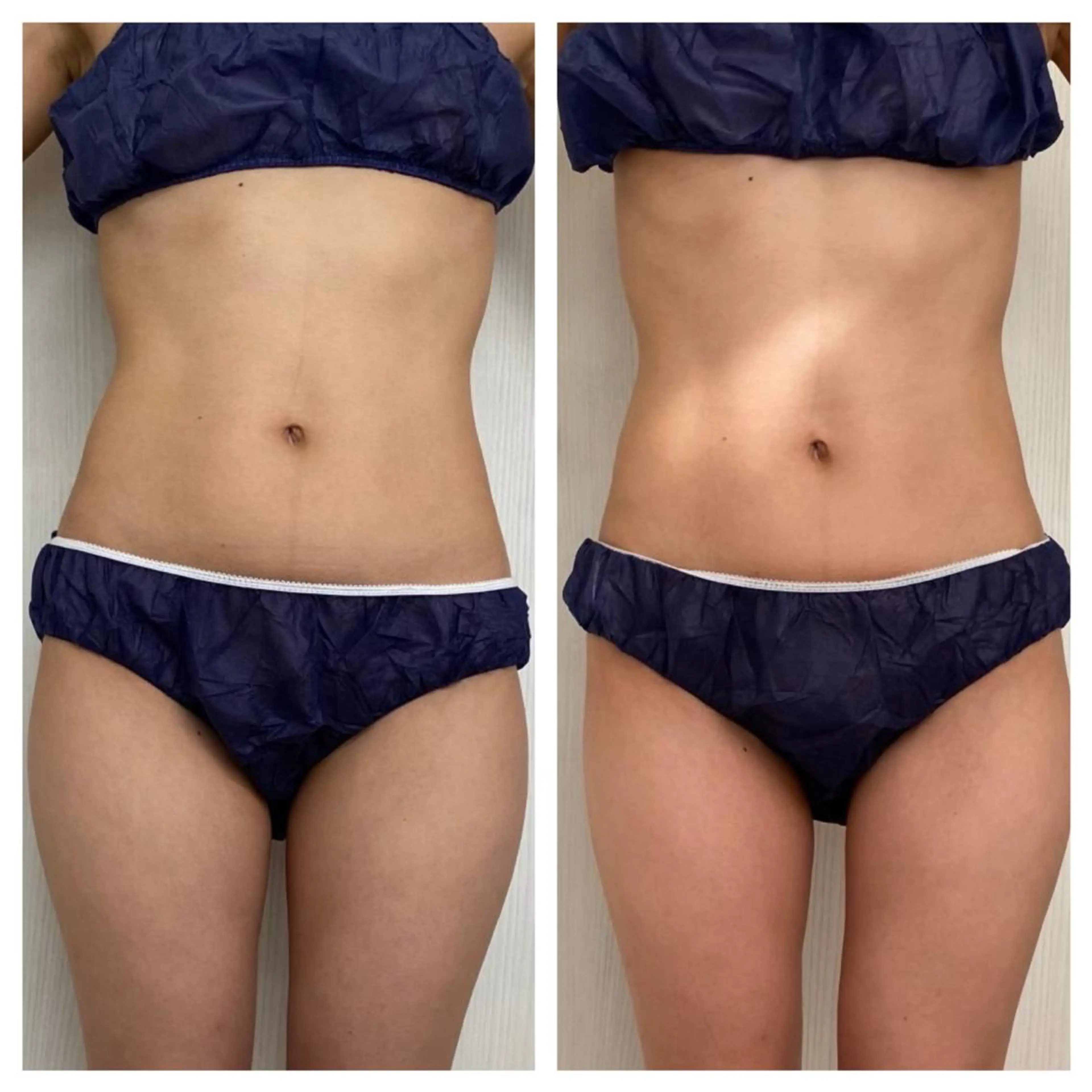 エステ 武藤 千裕のエステ・リラクイメージ