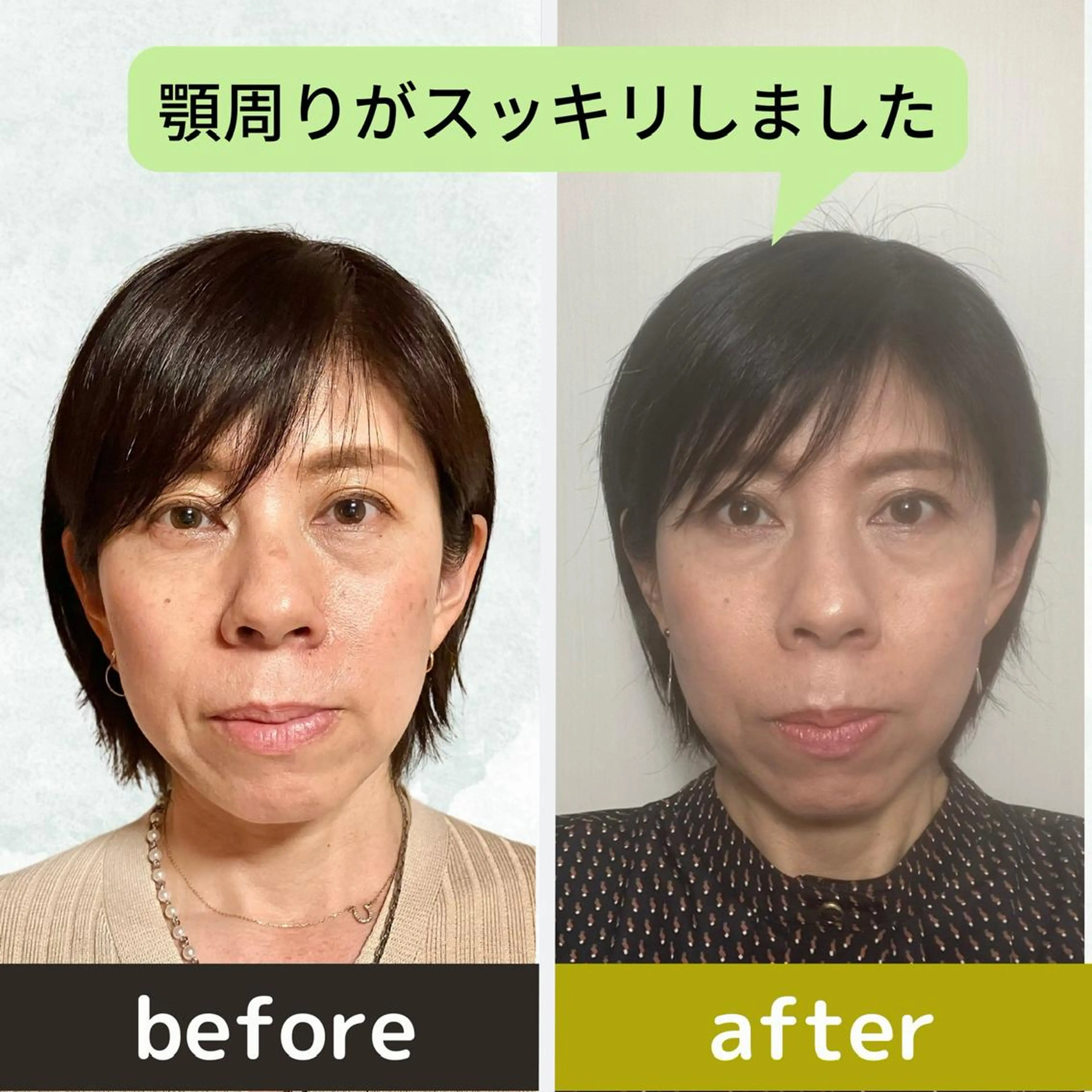 エステ リラク ヘイワポッド所属・小顔&ヘッドスパ/ もりもとまきみのエステ・リラクイメージ