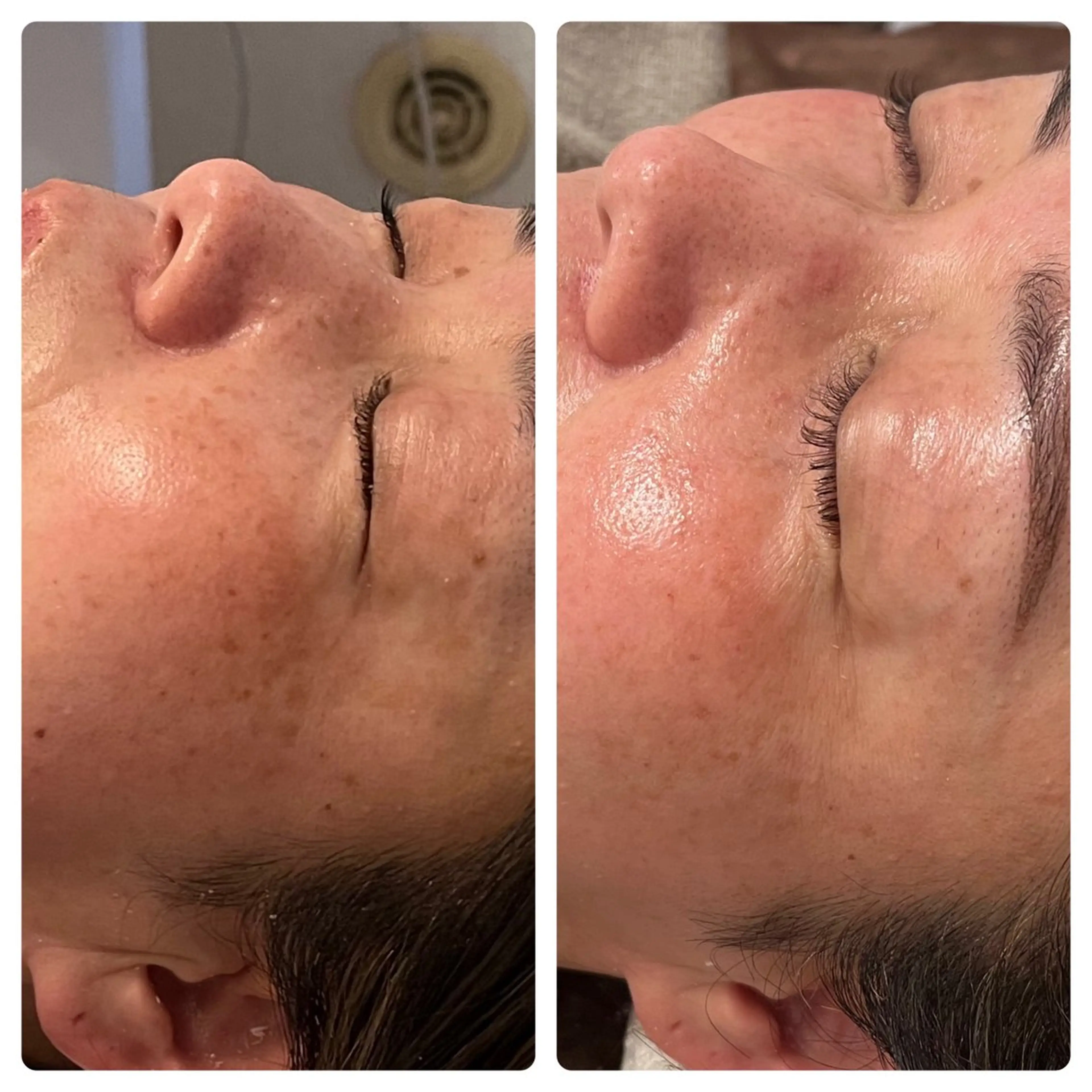 Beauty Salon AZUL所属・ビューティーサロン AZULのエステ・リラクイメージ