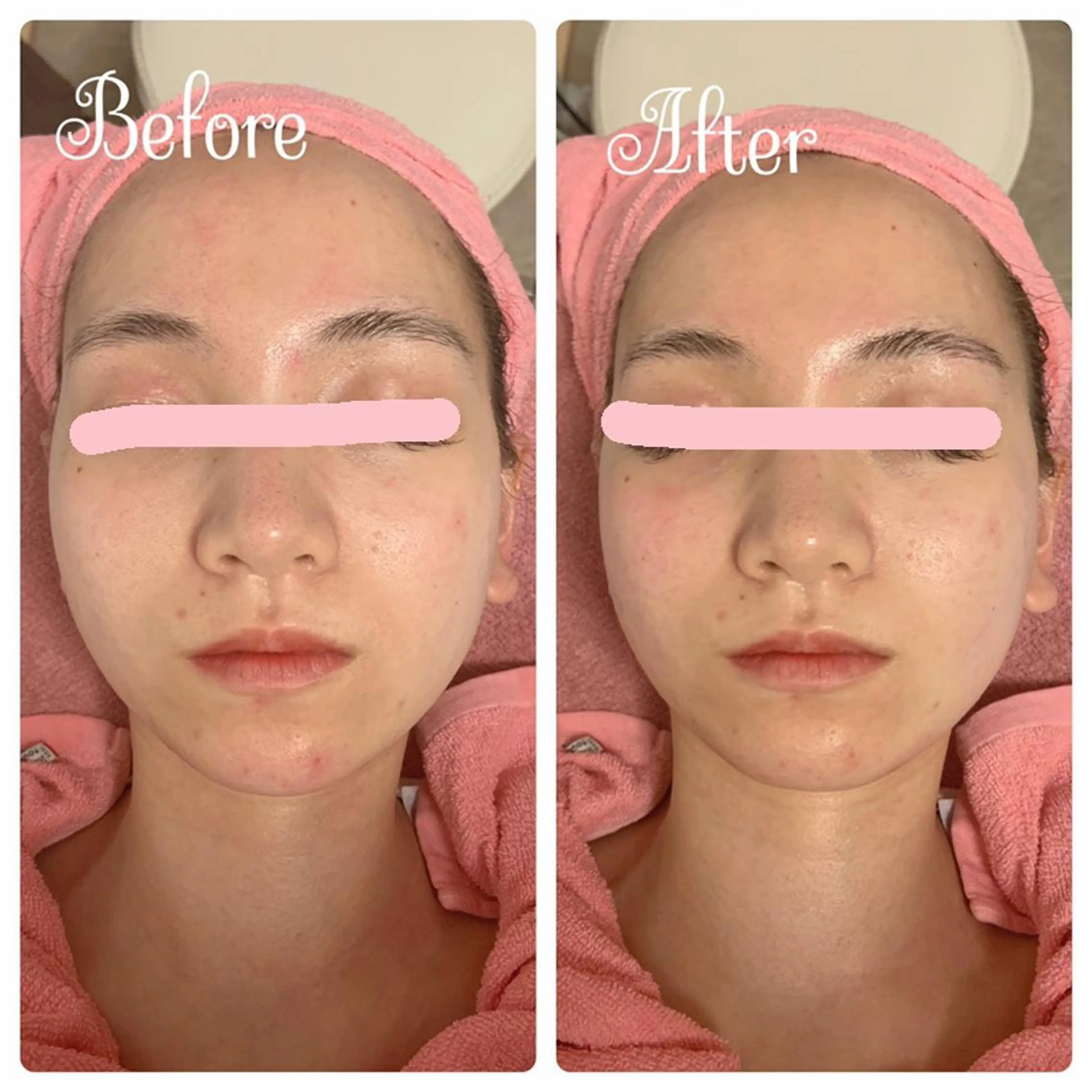 透明感の肌Lino malieのエステ・リラクイメージ