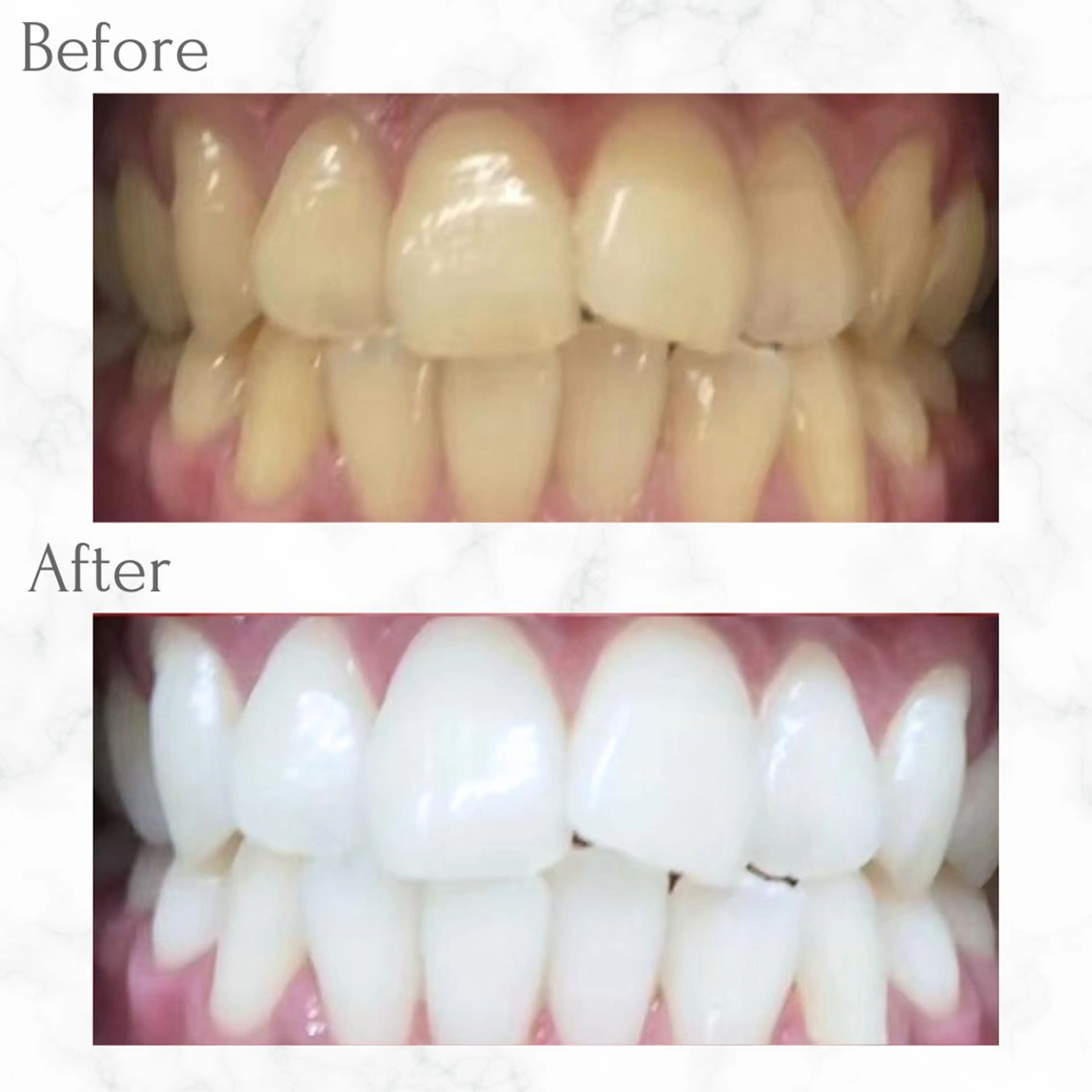 その他 セルフホワイトニング エクシア天神店のその他イメージ