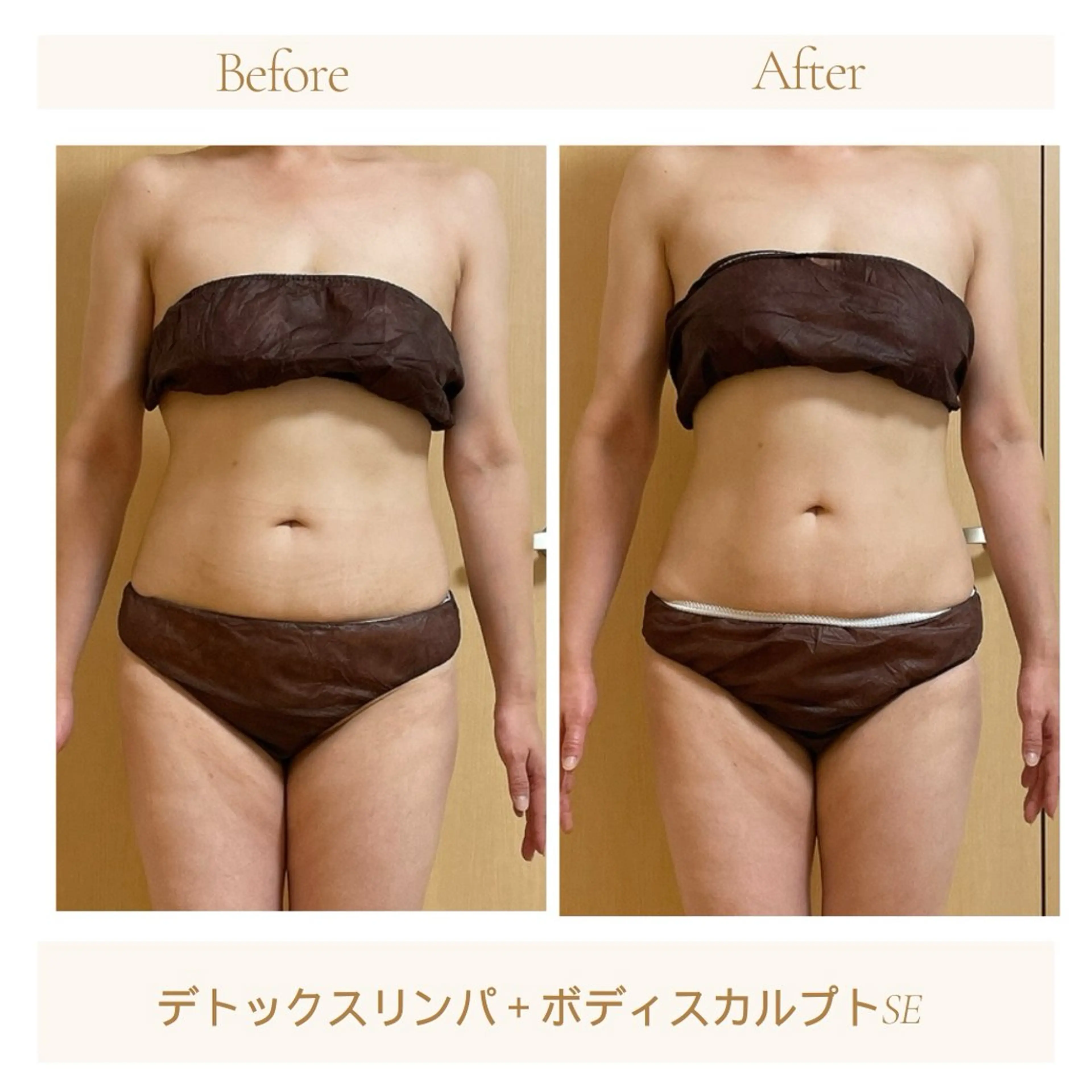 エステ リラク 小顔・デトックスリンパ専門サロンRadiant Muse (ラディアントミューズ)所属・小顔・たるみ改善 ラディアントミューズのエステ・リラクイメージ