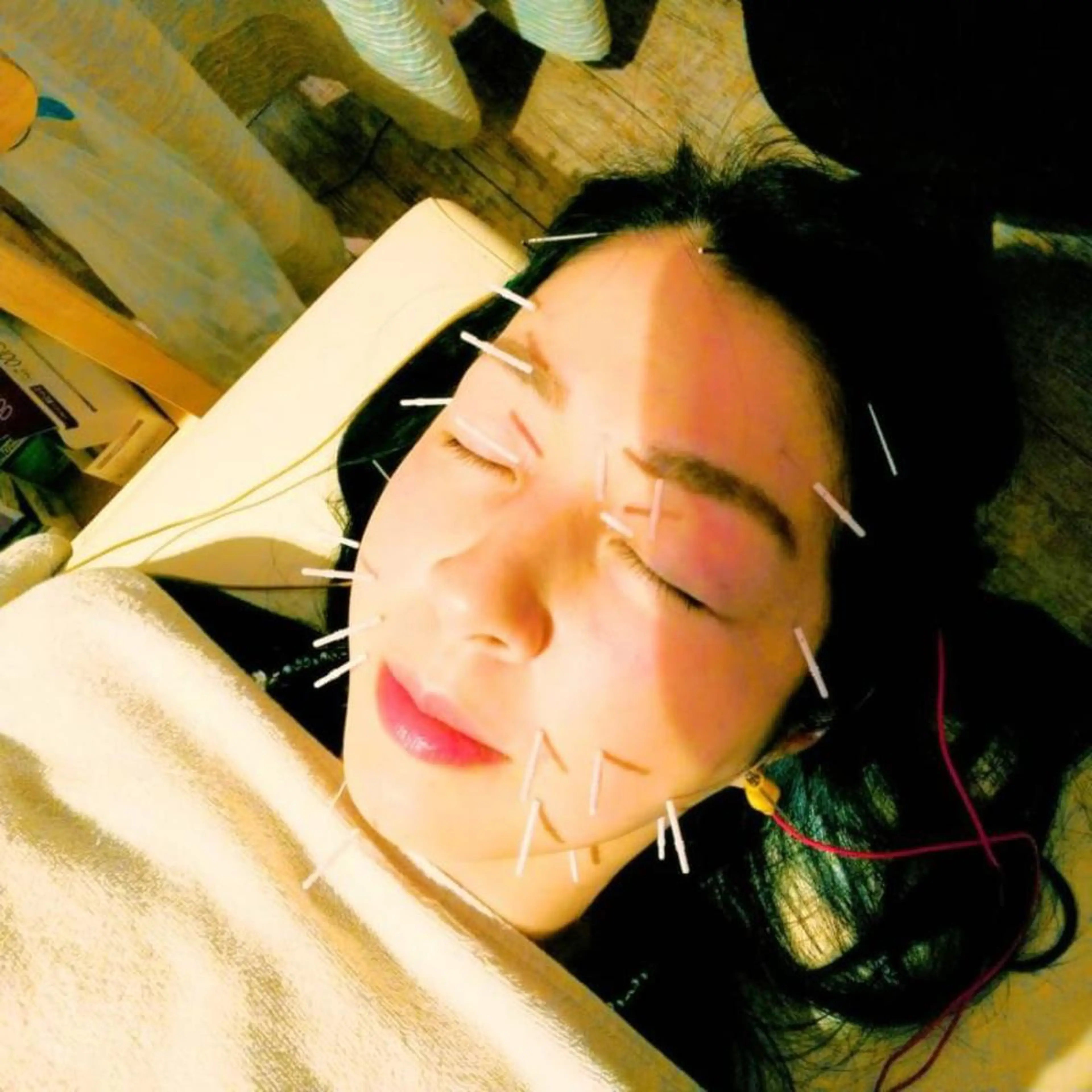 むくみたるみ専門☆ 美容鍼・小顔矯正のエステ・リラクイメージ