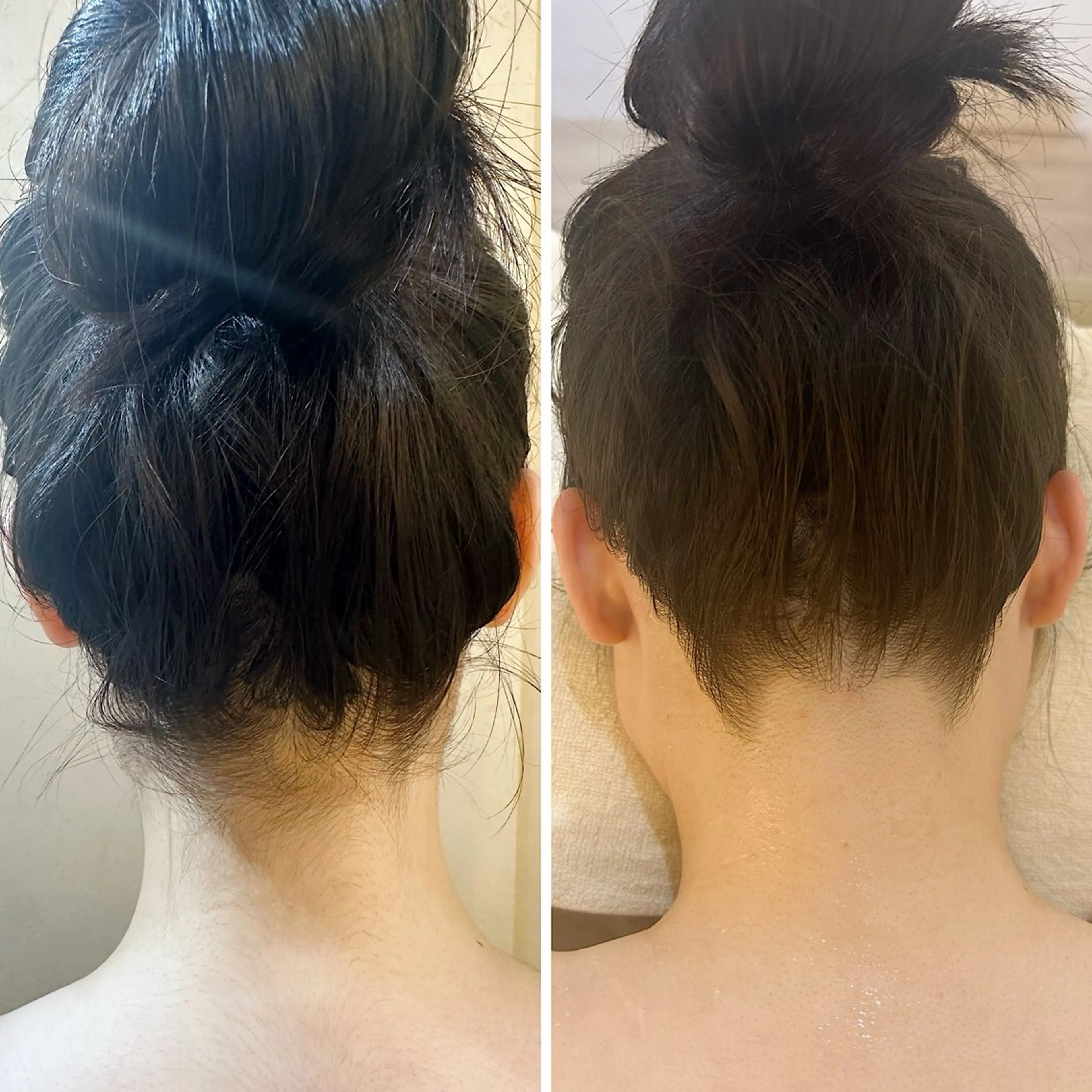 脱毛 うなじ脱毛/美肌脱毛 LABELのエステ・リラクイメージ