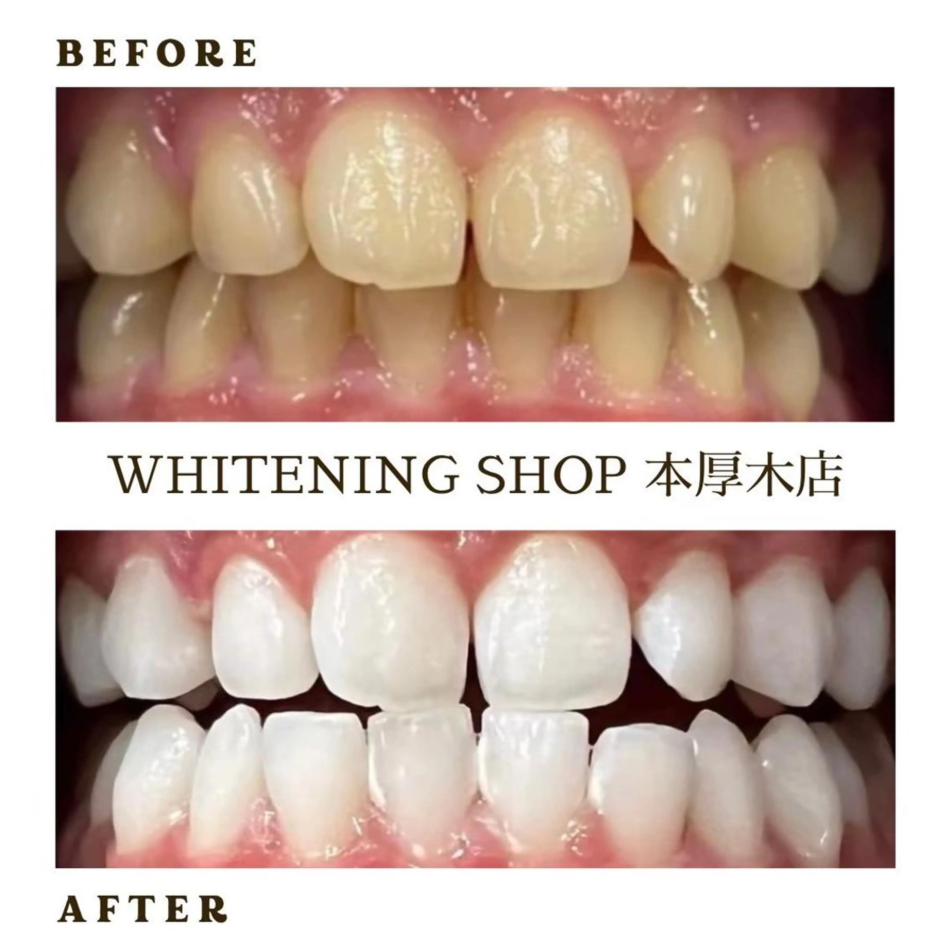 メンズ その他 ホワイトニング ショップ本厚木のその他イメージ