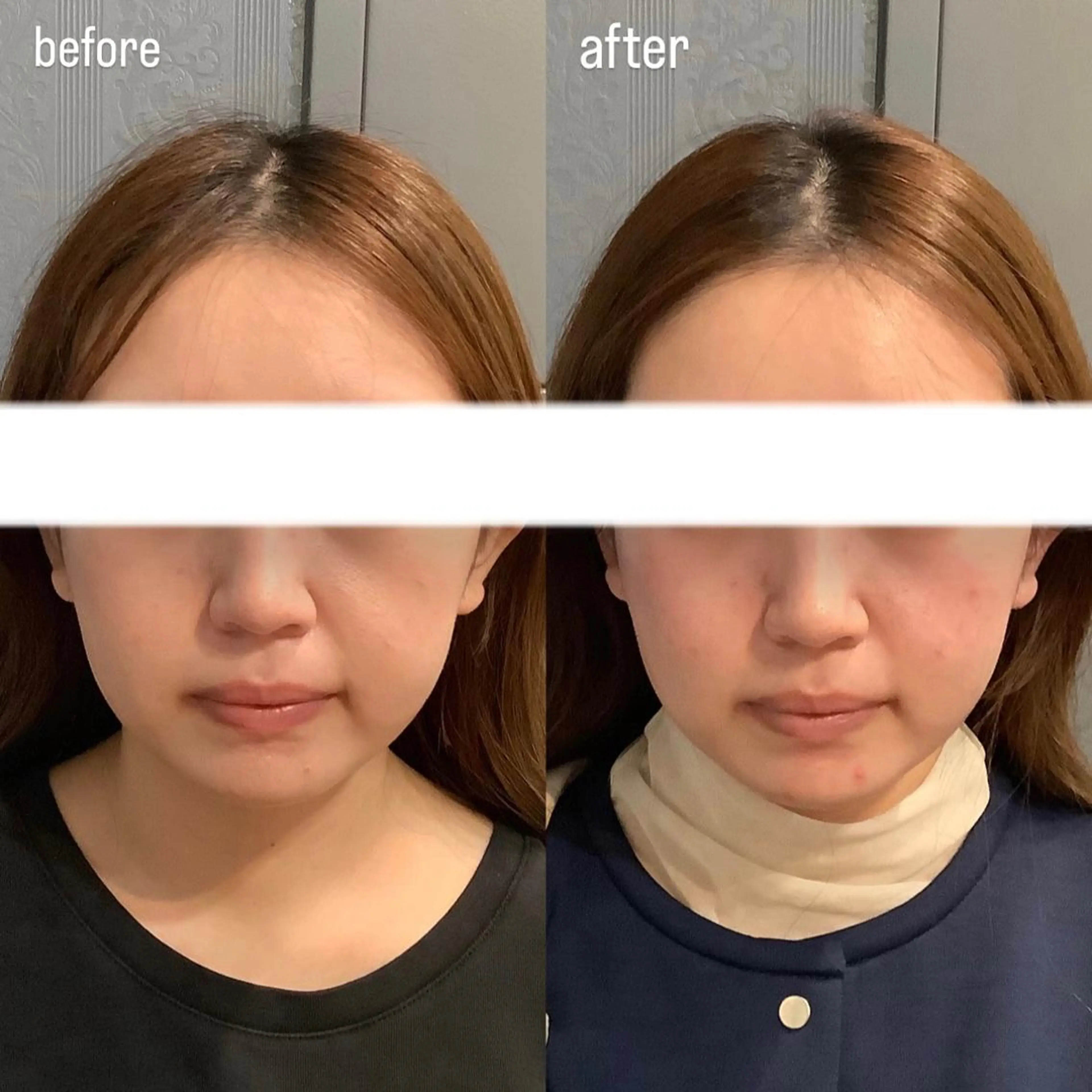 エステ リラク エステサロンino.colore'所属・小顔サロン ino.coloreのエステ・リラクイメージ