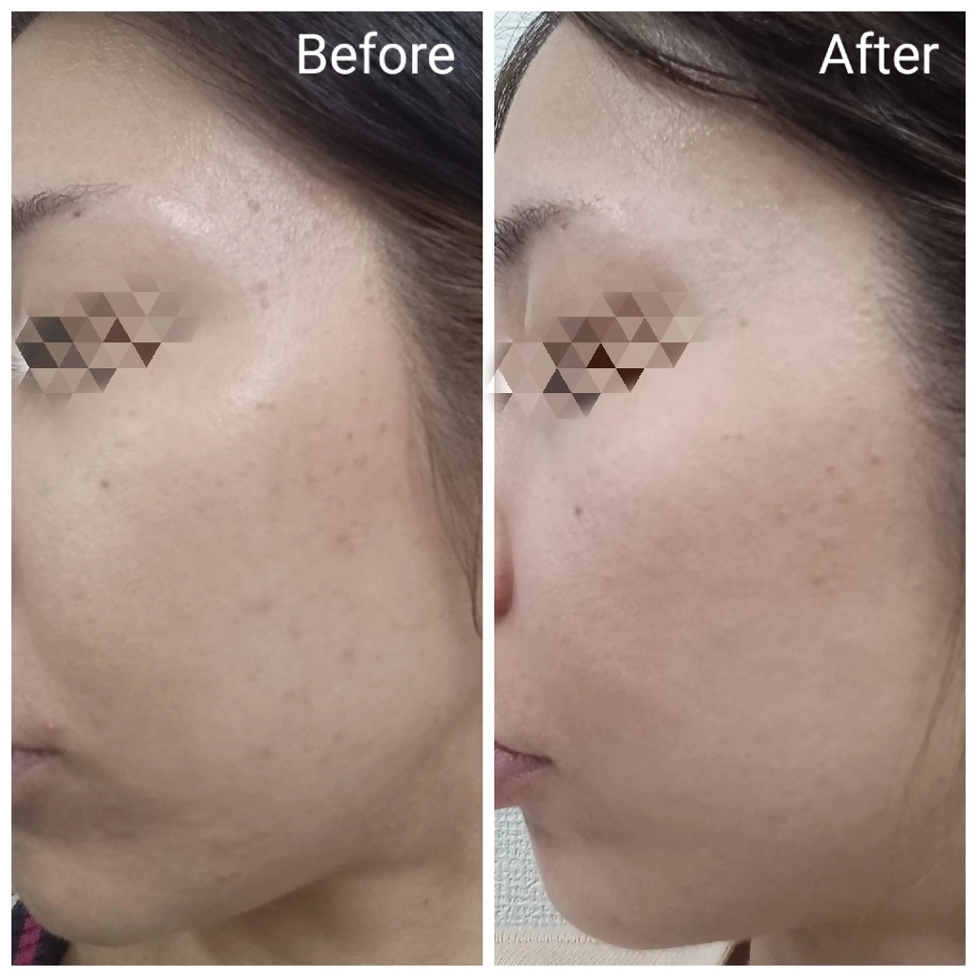 エステ リラク 肌質改善Beauty salon Renのエステ・リラクイメージ