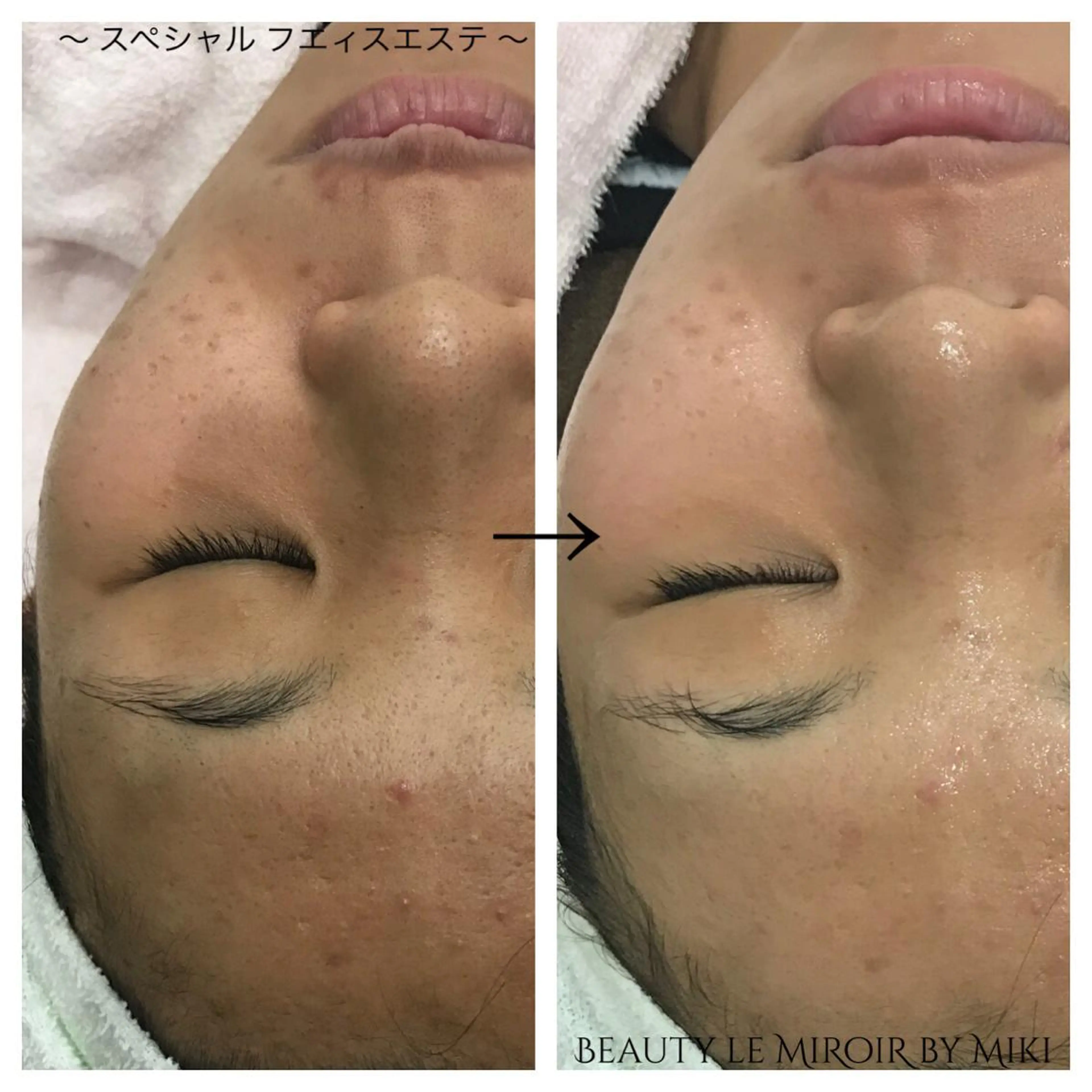 ビューティー ミロワールのエステ・リラクイメージ