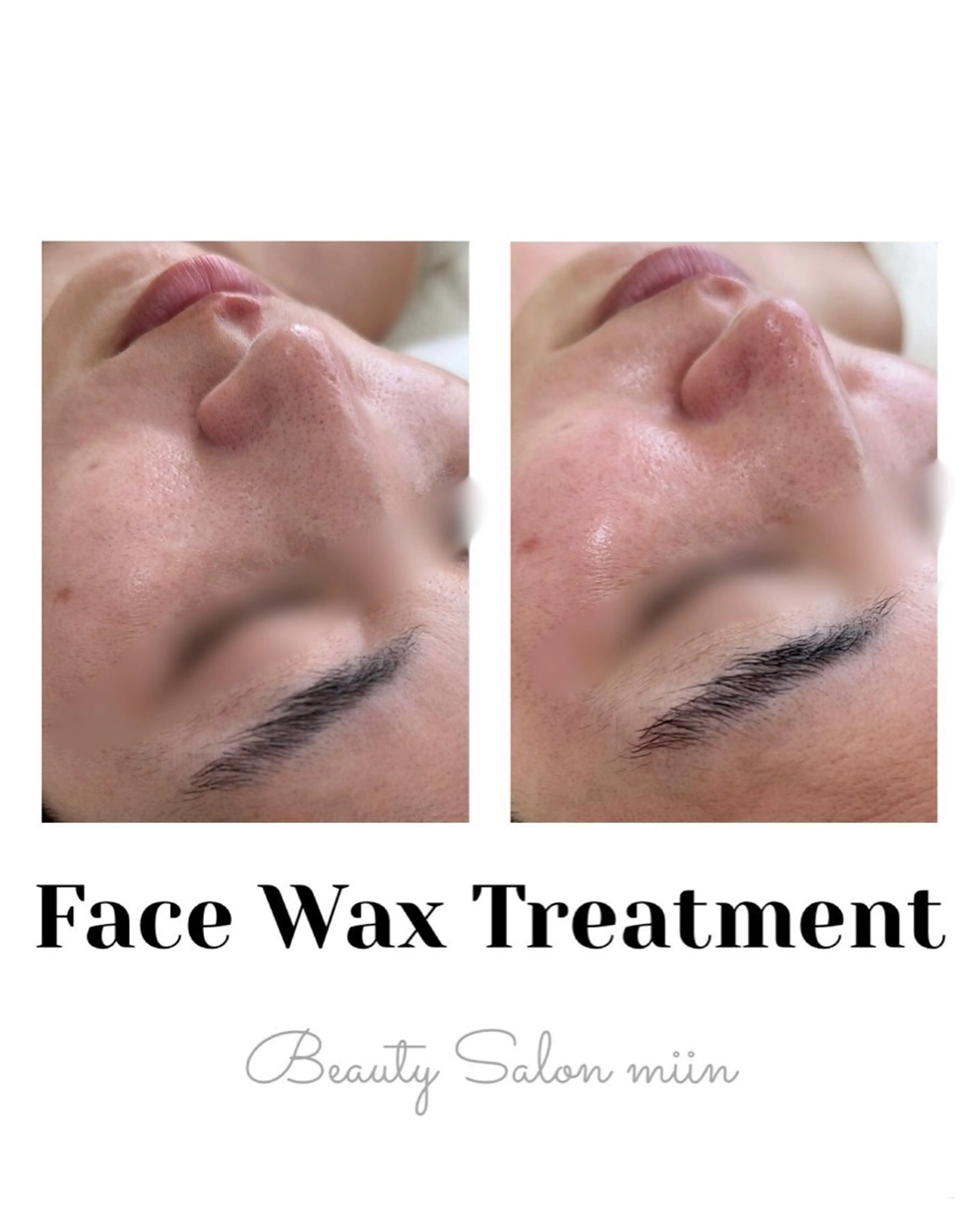 リラク 韓国肌管理 白玉肌管理®︎のエステ・リラクイメージ