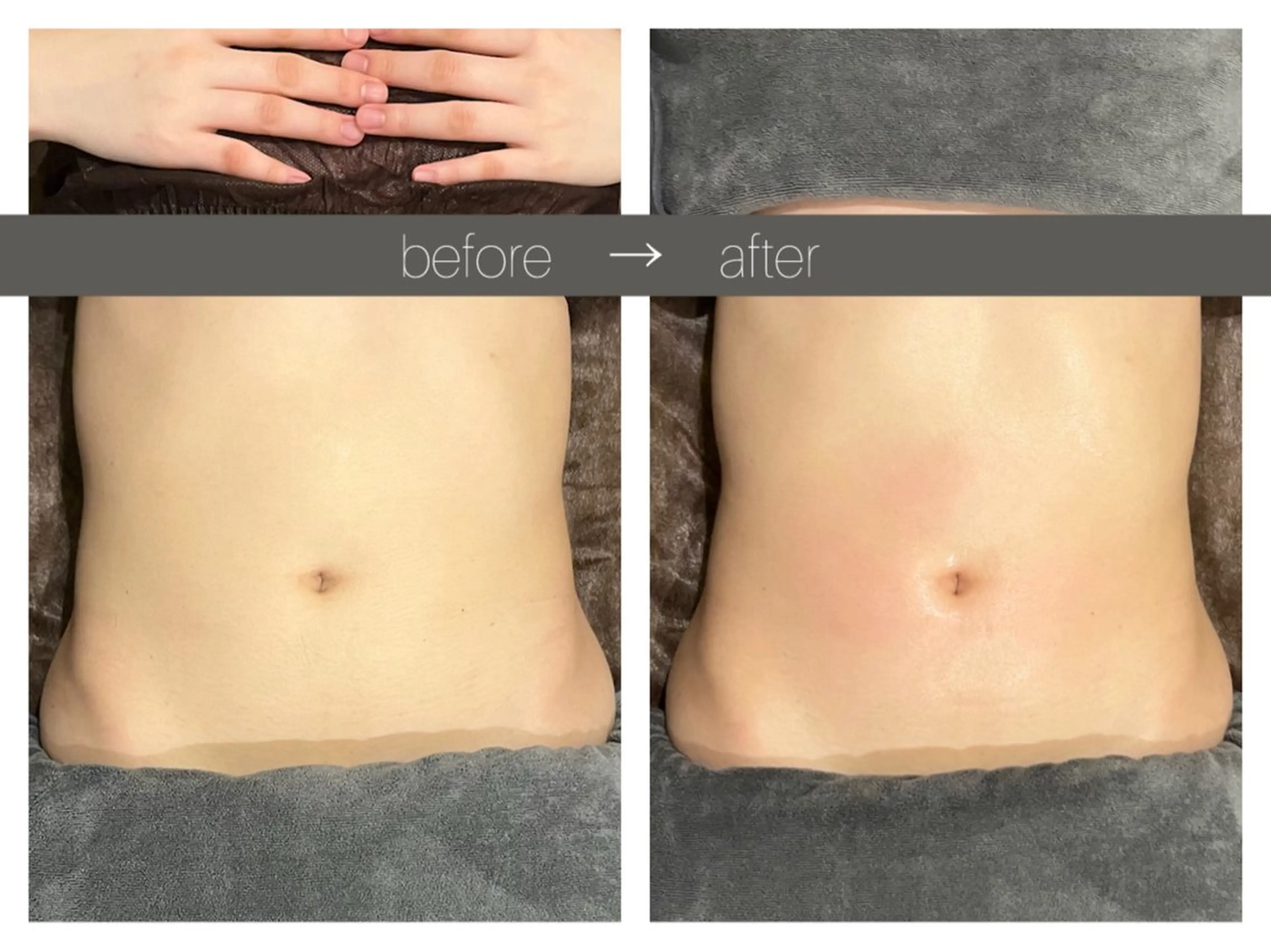 エステ リラク ☆痩身/小顔☆ コルギのエステ・リラクイメージ