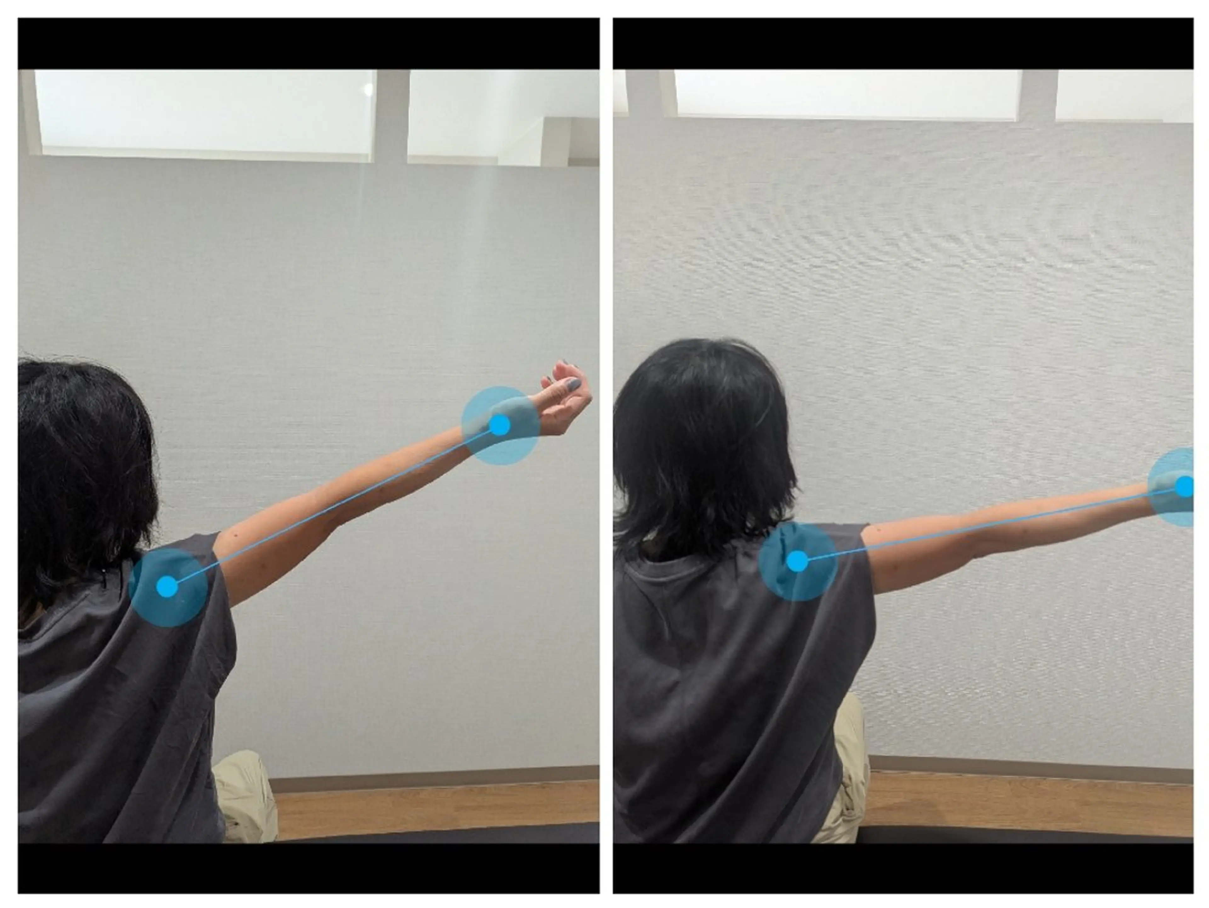 肩甲骨はがしの写真