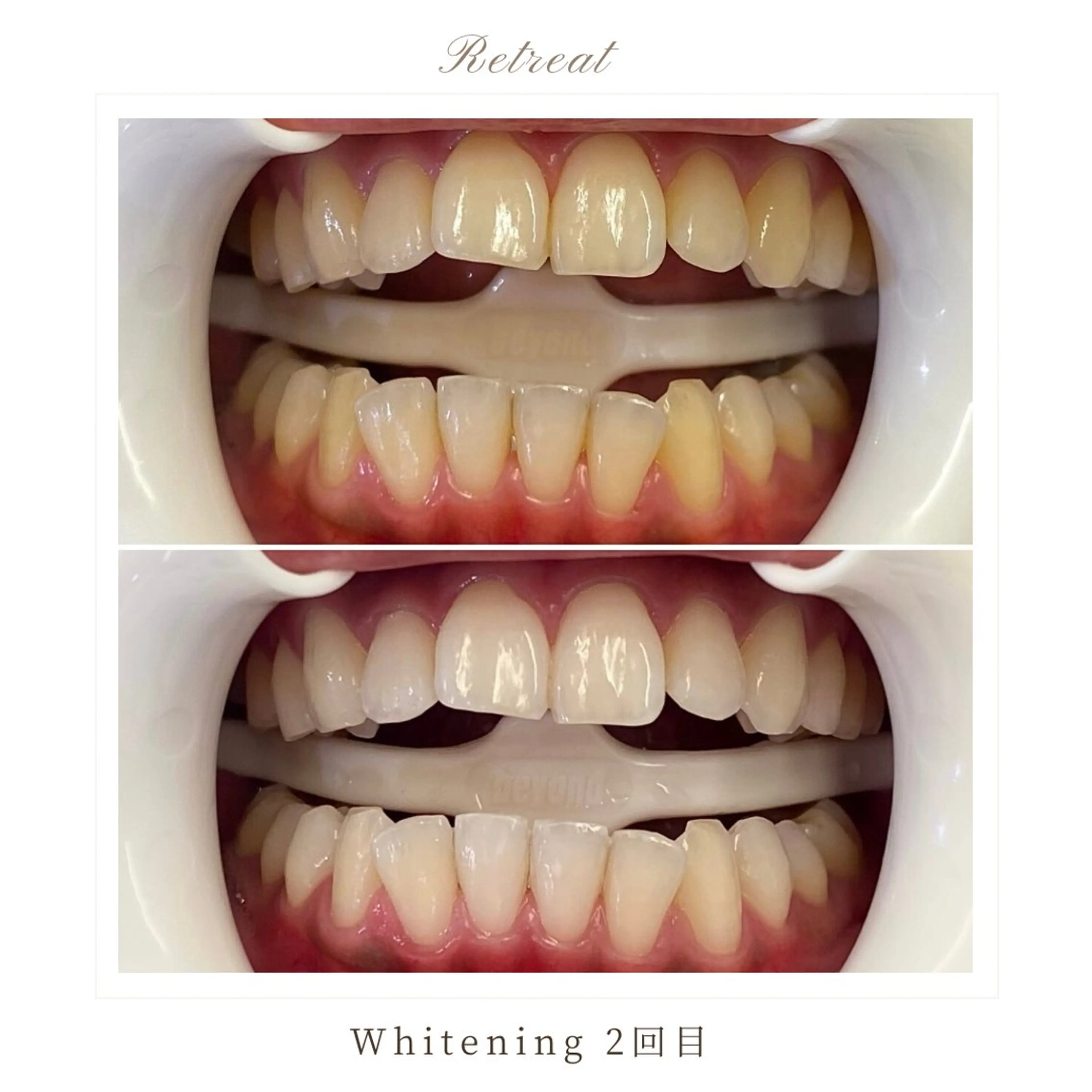 Retreatリトリート所属・歯科医院提携 Retreatのエステ・リラクイメージ