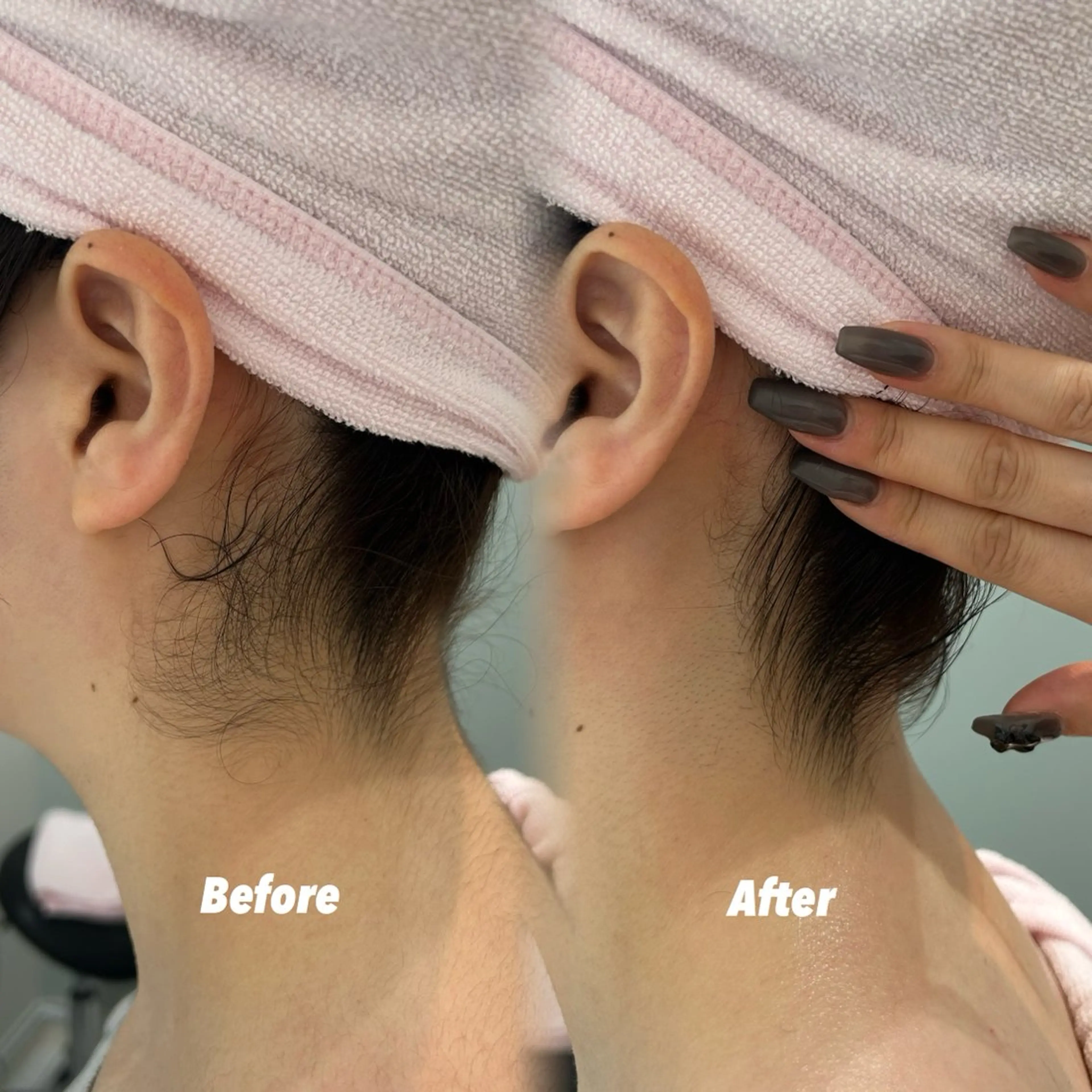 その他 🫧美しい素肌へ🫧 今成柚乃のその他イメージ