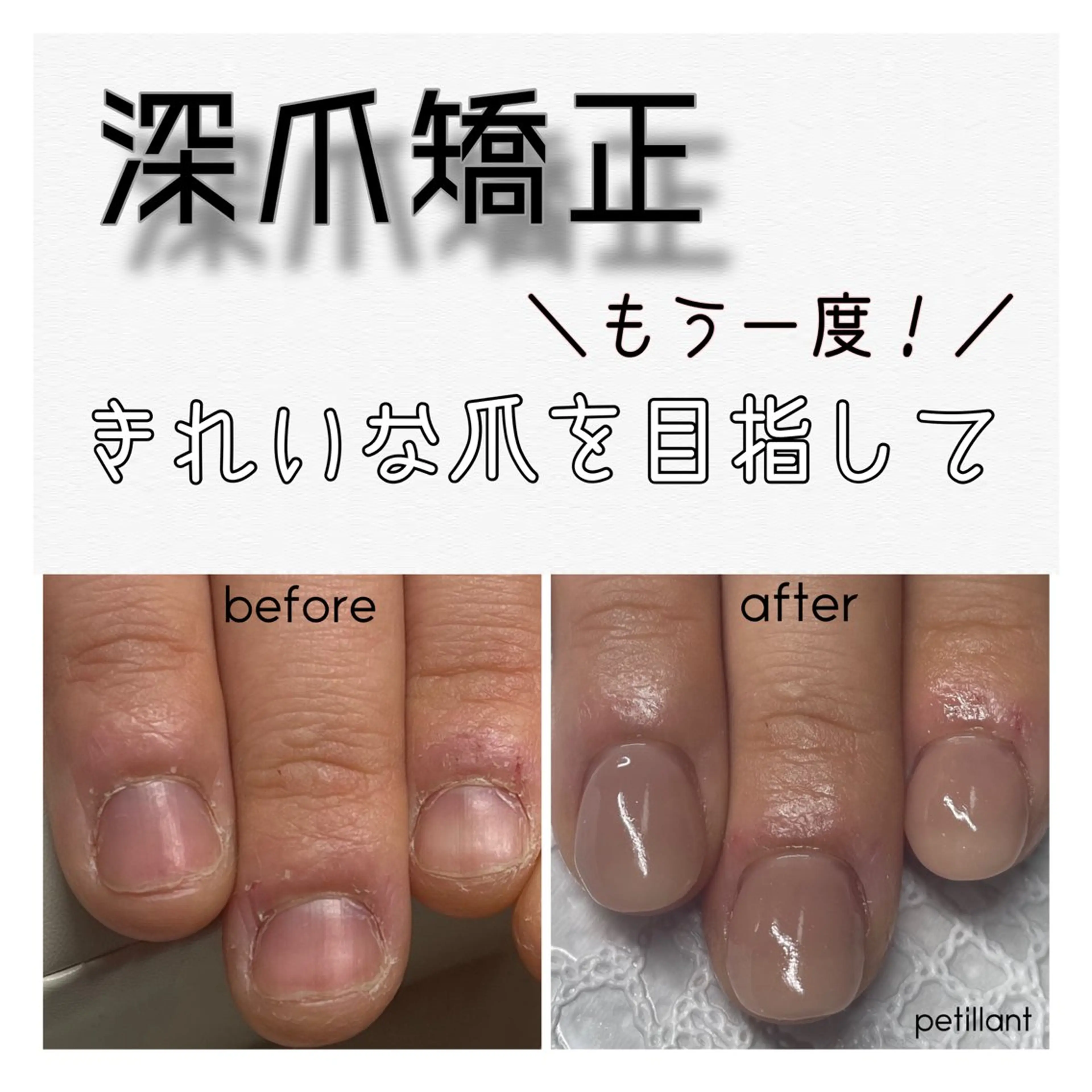ネイル ハンドネイル ハンドケア petillant所属・nail salon petillantのネイルデザイン