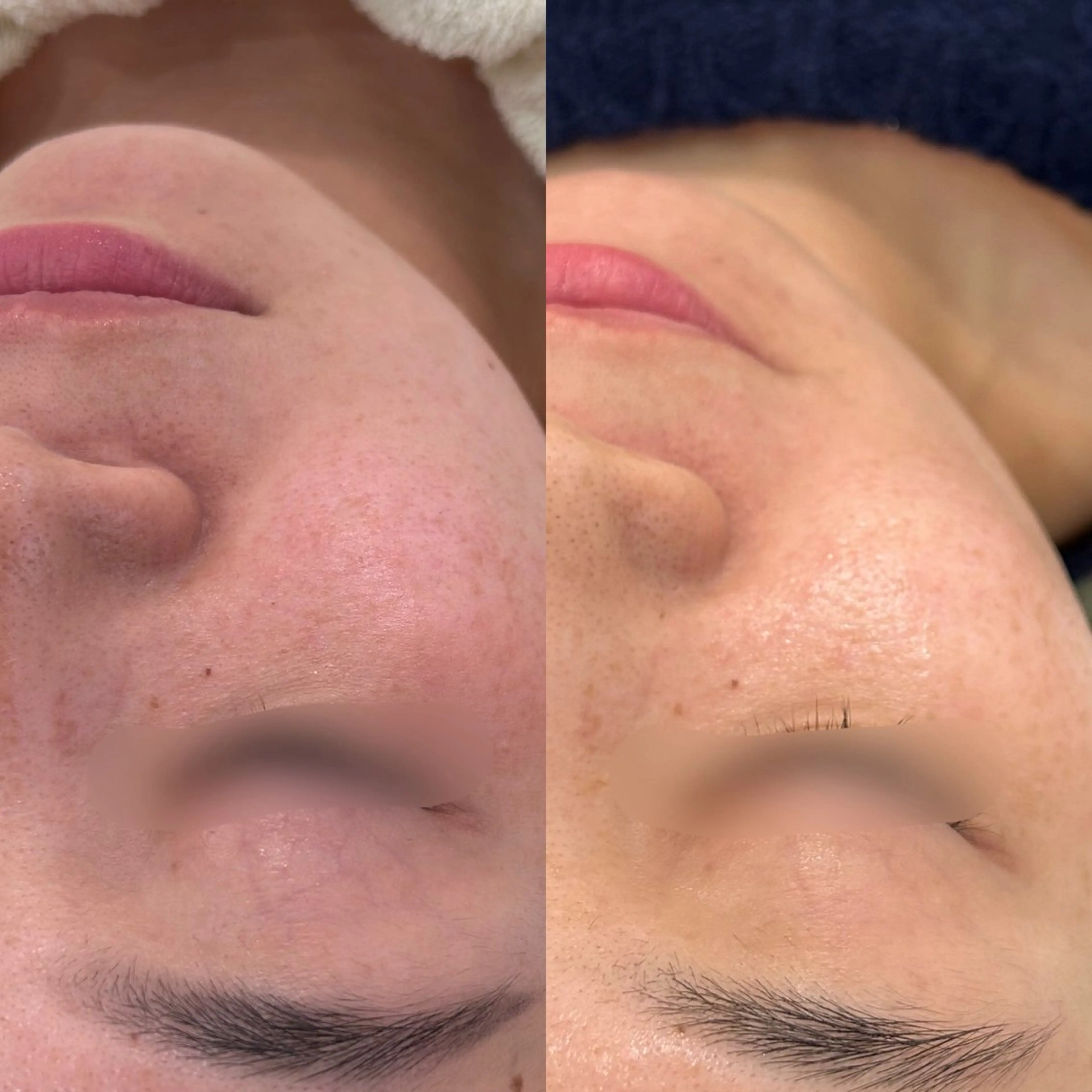 エステ 〈etre〉トータルビューティーサロン所属・etre - 韓国肌管理 -のエステ・リラクイメージ